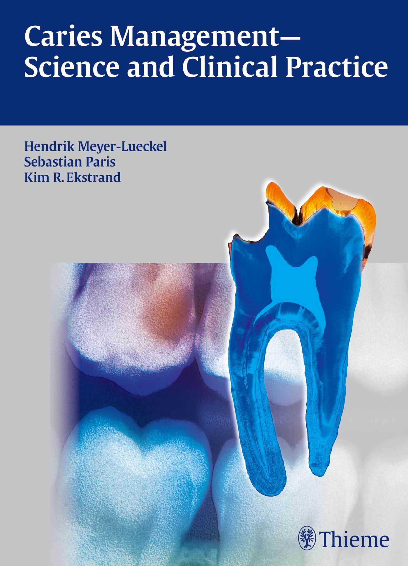 Caries Management - Science and Clinical Practice, 9783131547118