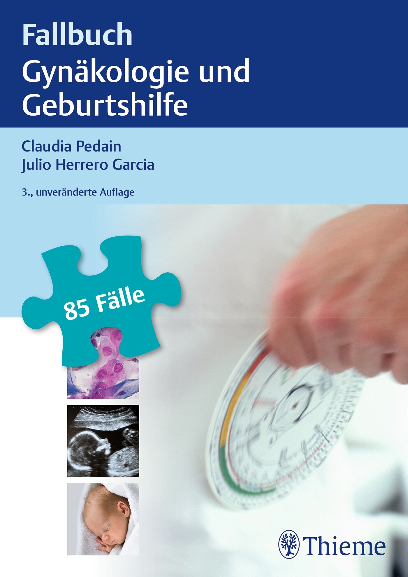 Fallbuch Gynäkologie und Geburtshilfe, 9783132415584