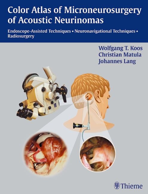 Color Atlas of Microsurgery of Acoustic Neurinomas | 9783131276612