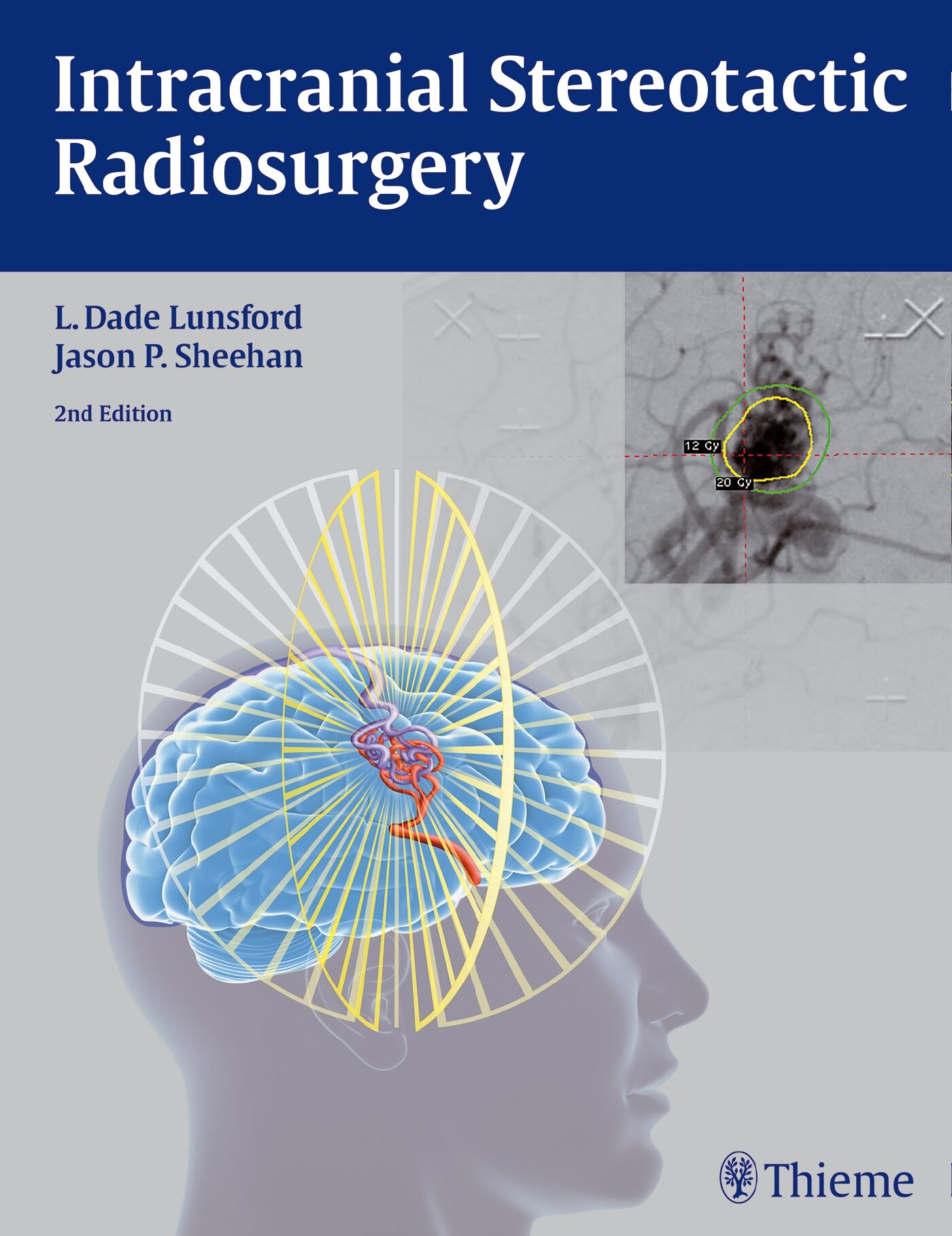Intracranial Stereotactic Radiosurgery, 9781626230323