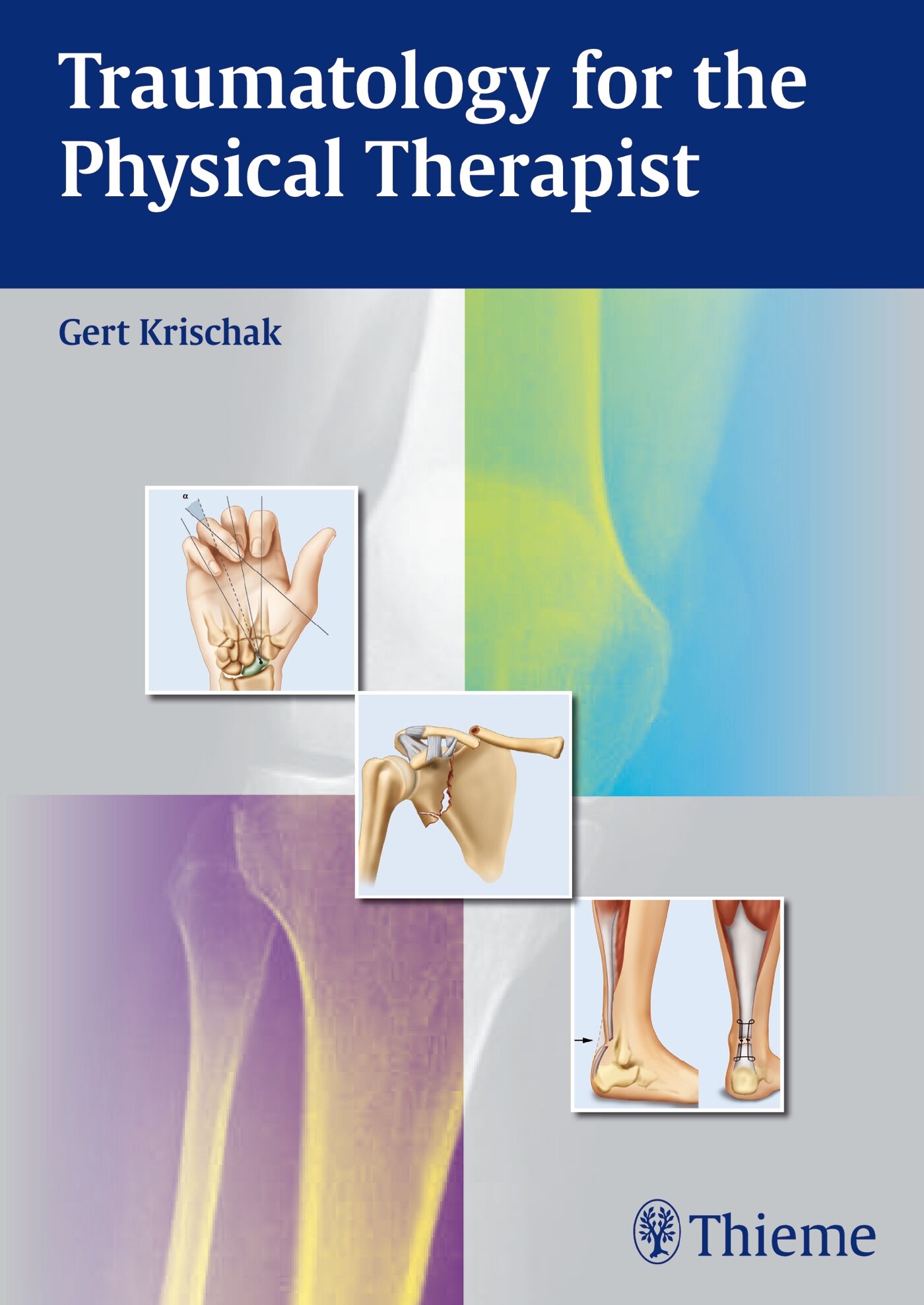 Traumatology for the Physical Therapist, 9783131724212
