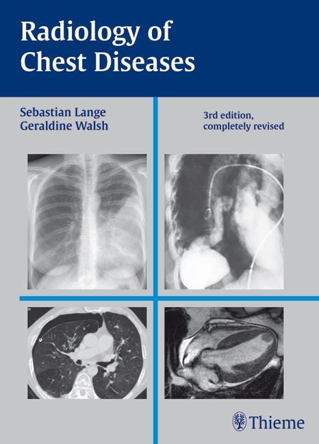 Radiology of Chest Diseases, 9783137407034