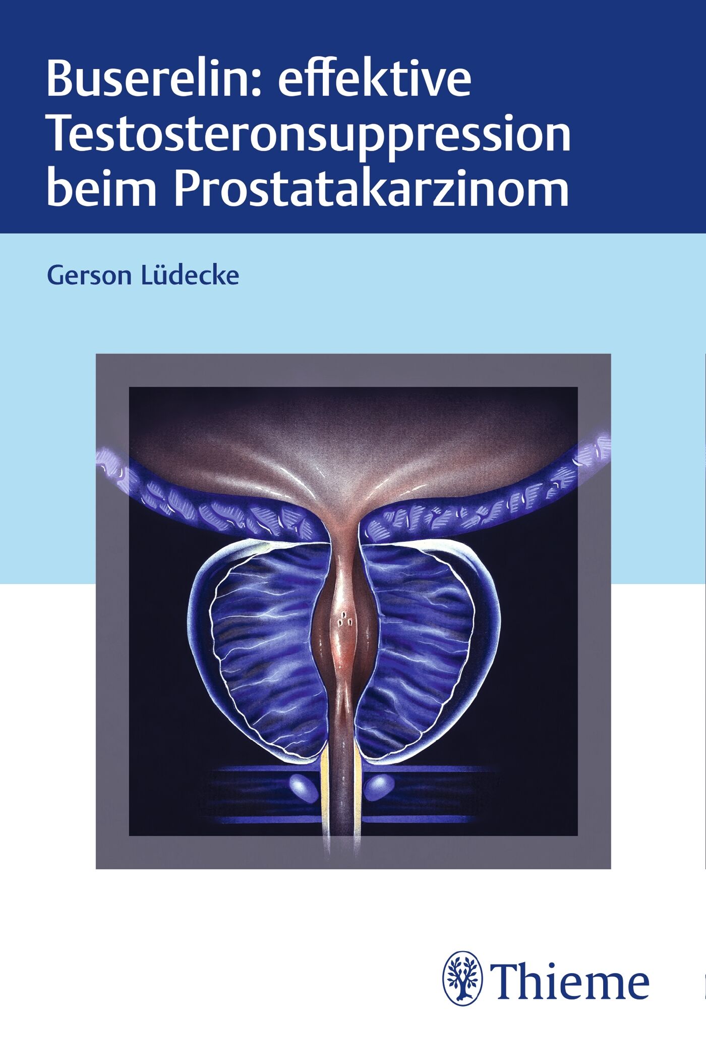 Buserelin: effektive Testosteronsuppression beim Prostatakarzinom, 9783132434479