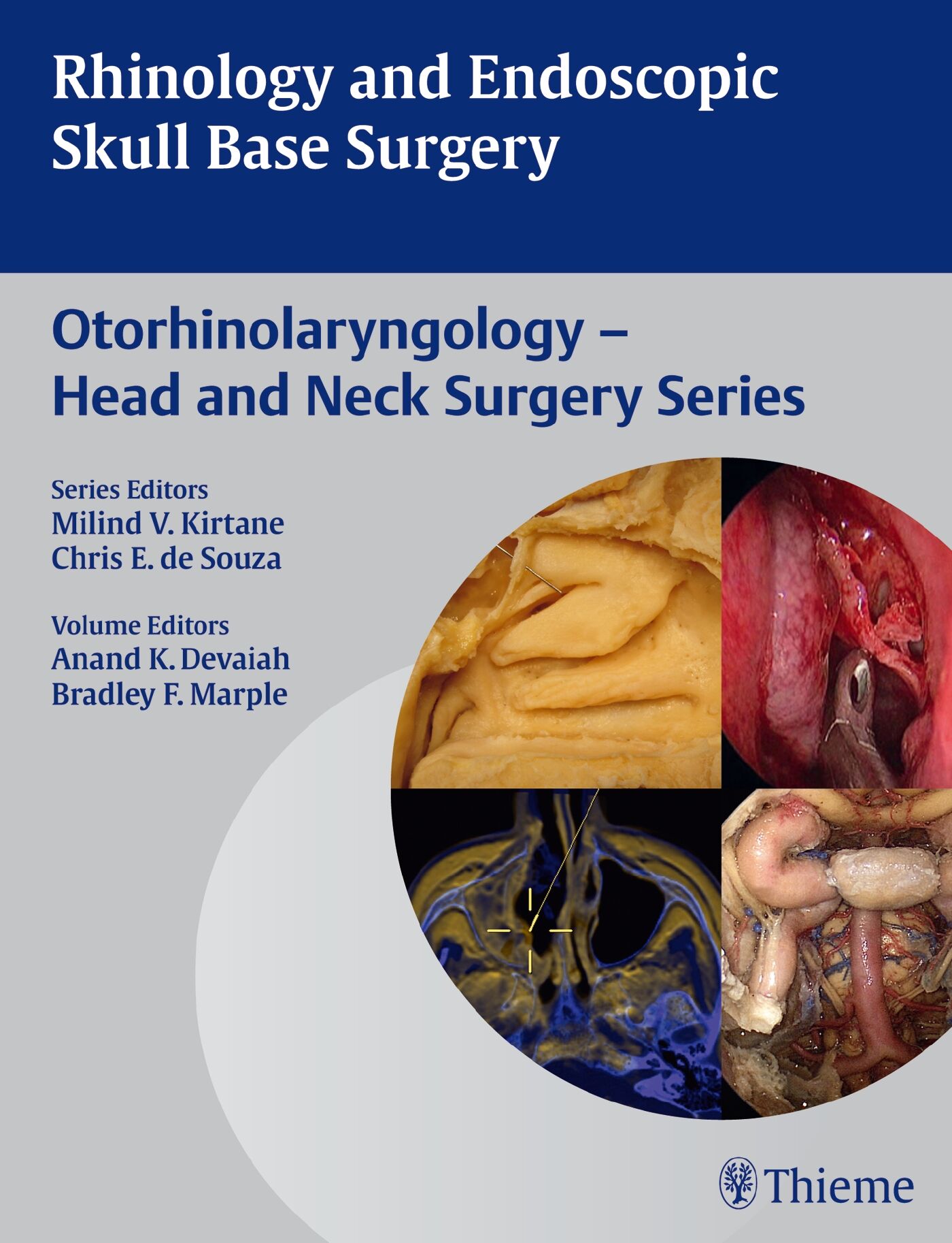 Rhinology and Endoscopic Skull Base Surgery, 9789382076018