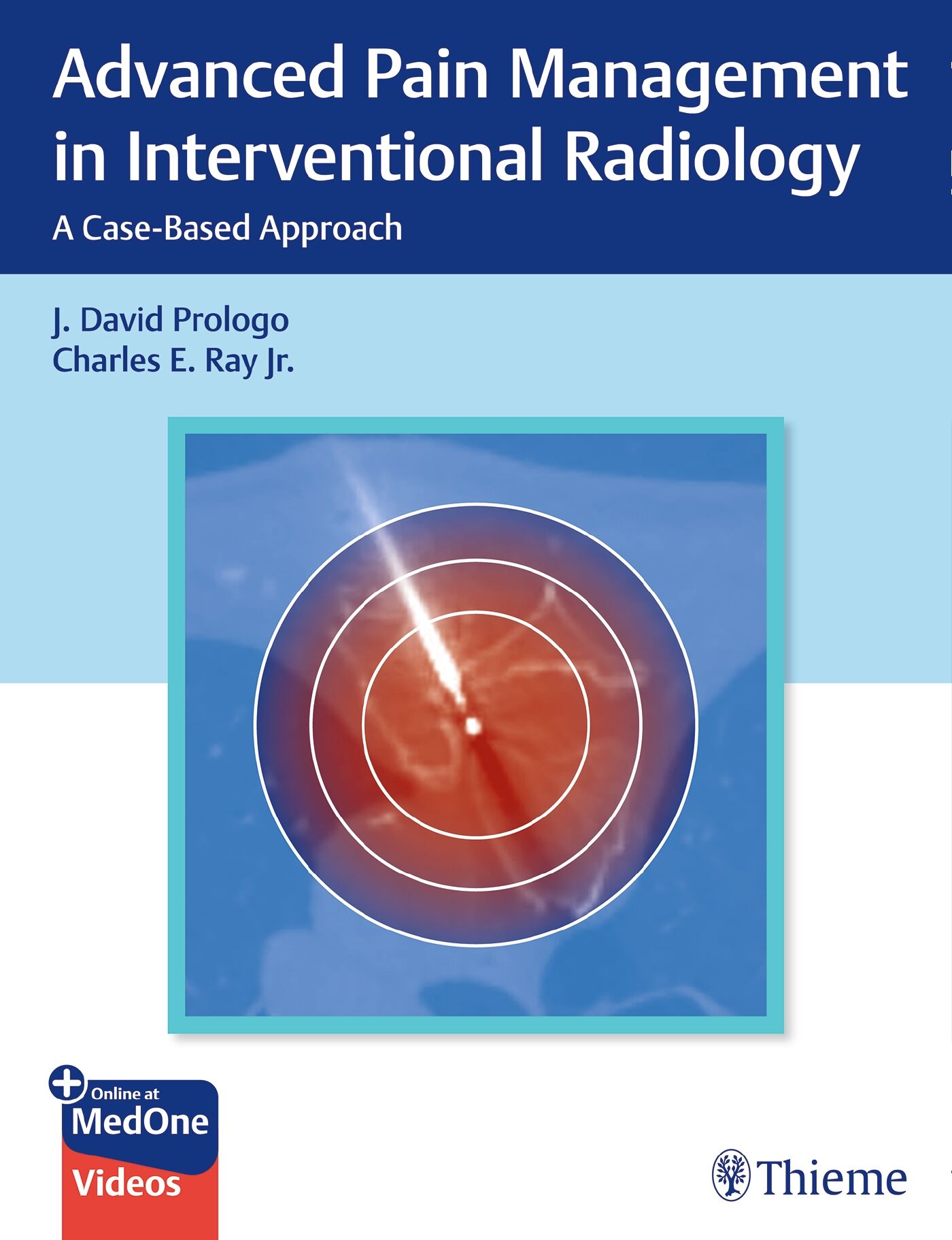 Advanced Pain Management in Interventional Radiology, 9781638536727