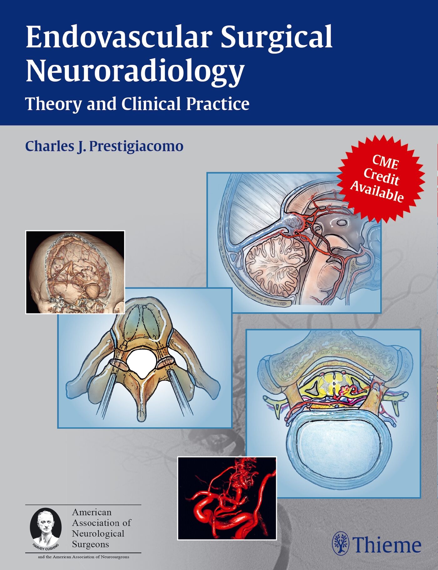 Endovascular Surgical Neuroradiology, 9781604060577