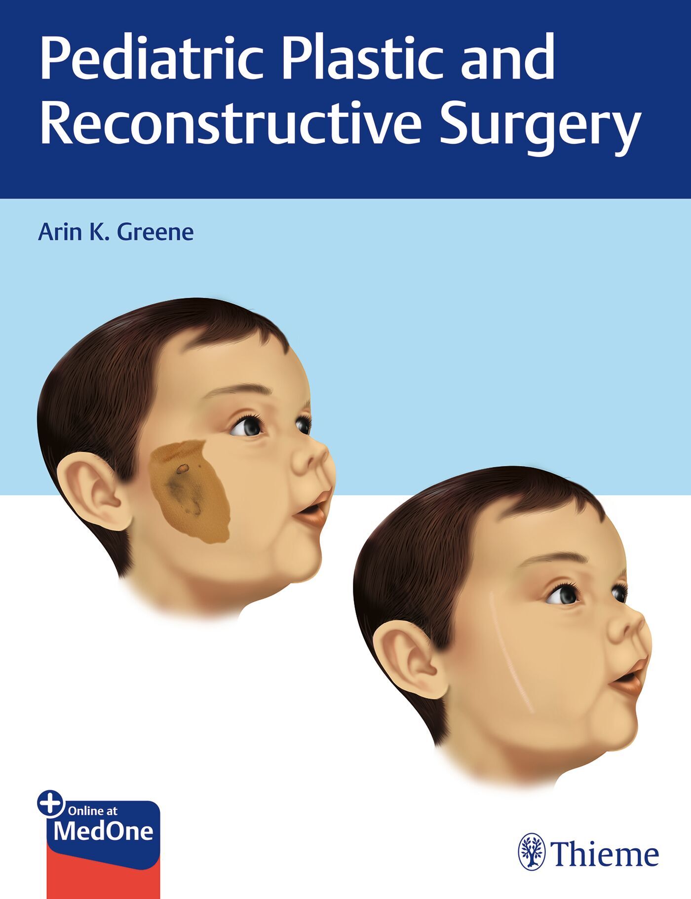 Pediatric Plastic and Reconstructive Surgery, 9781626232624