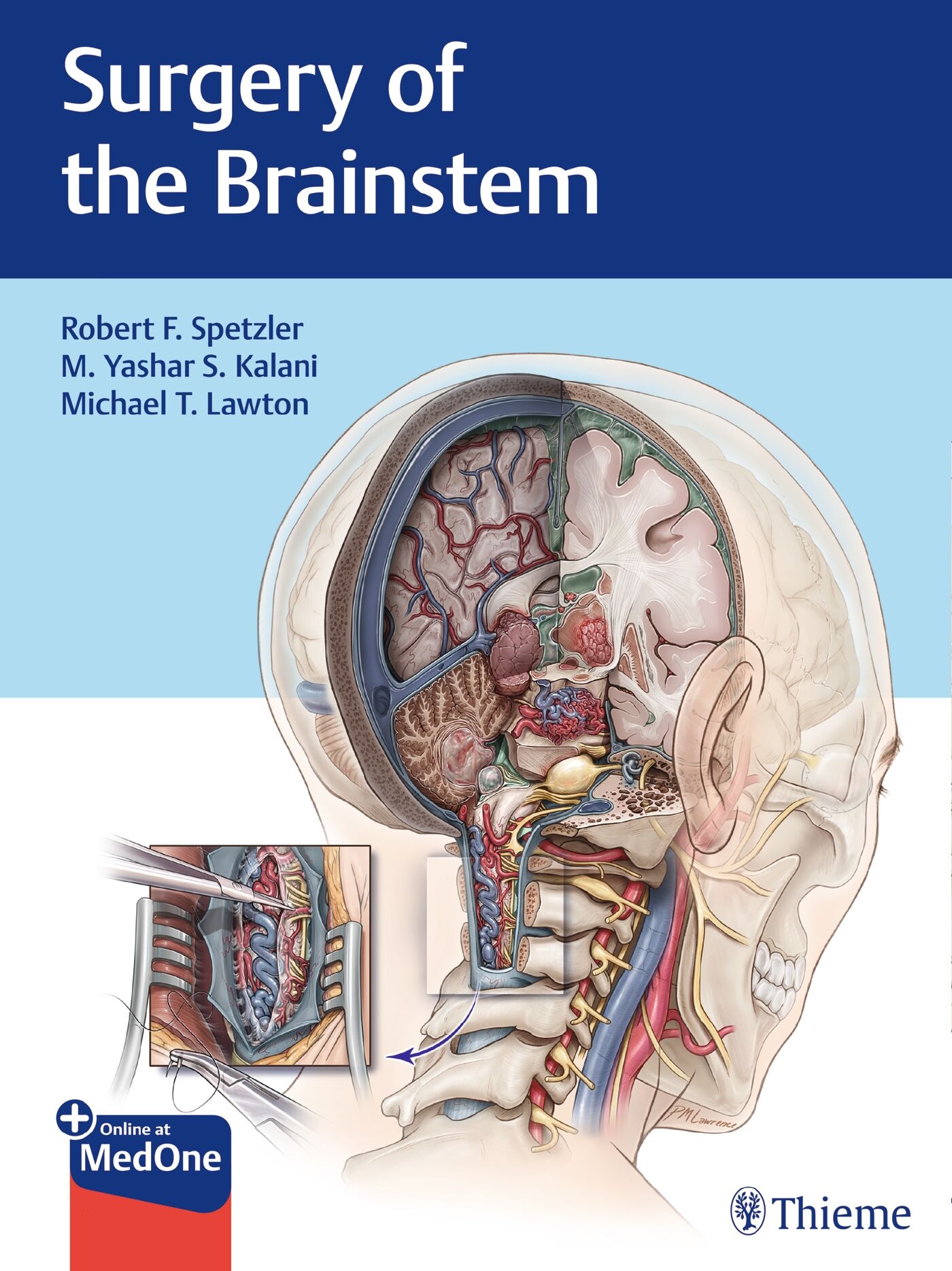 Surgery of the Brainstem, 9781626232914
