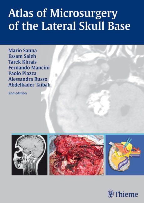 Atlas of Microsurgery of the Lateral Skull Base, 9783131010926