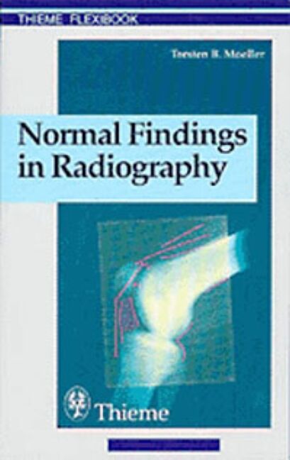 Normal Findings in Radiography, 9783131165312