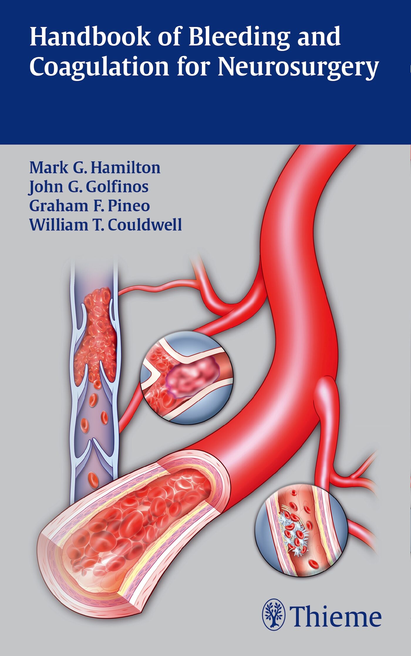 Handbook of Bleeding and Coagulation for Neurosurgery, 9781604065442