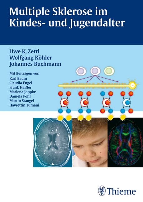 Multiple Sklerose im Kinder- und Jugendalter Mit Beiträgen von Karl Braun, Clau, 9783131598417