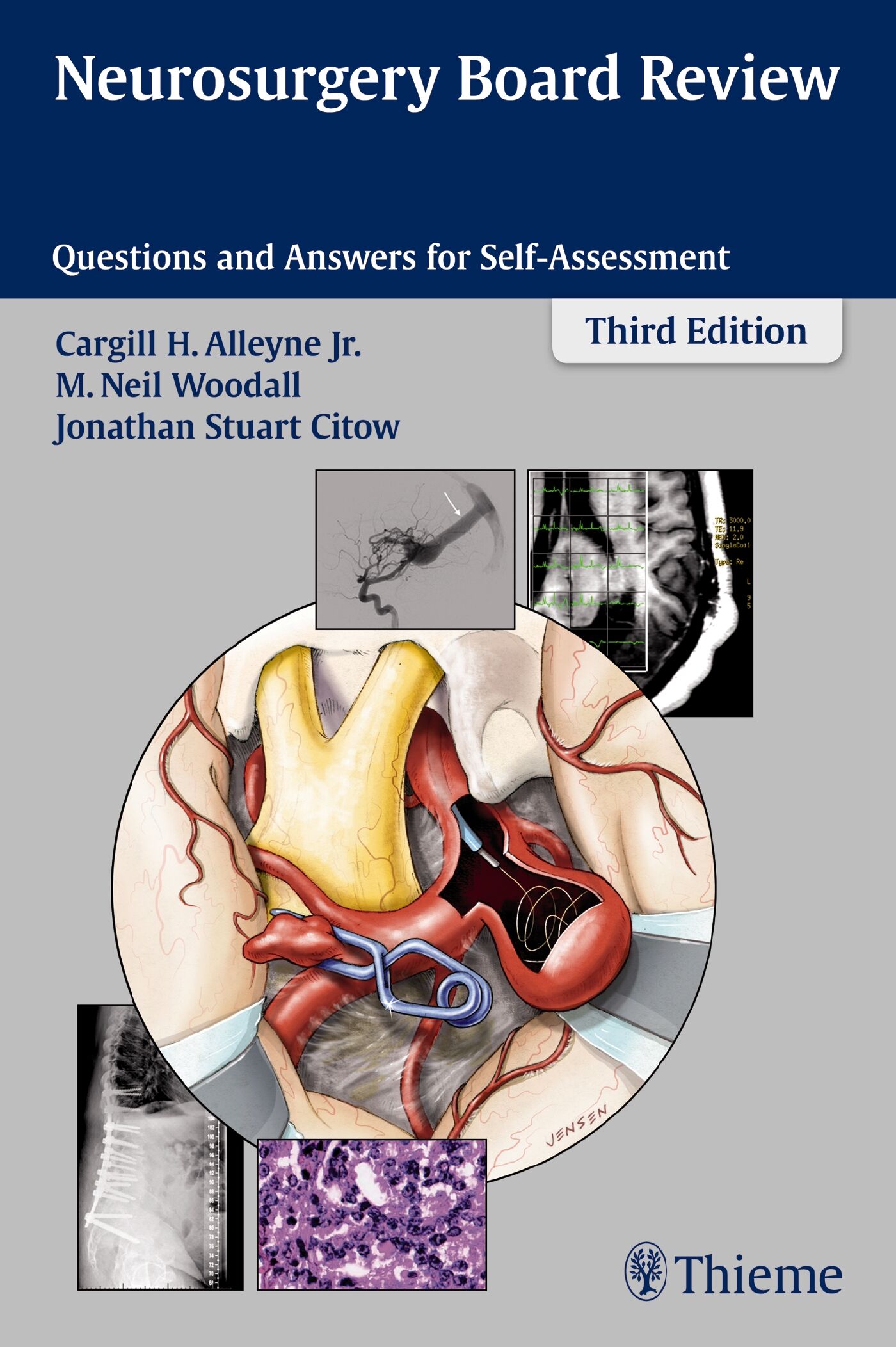 Neurosurgery Board Review | 9781626231047 | Thieme Webshop