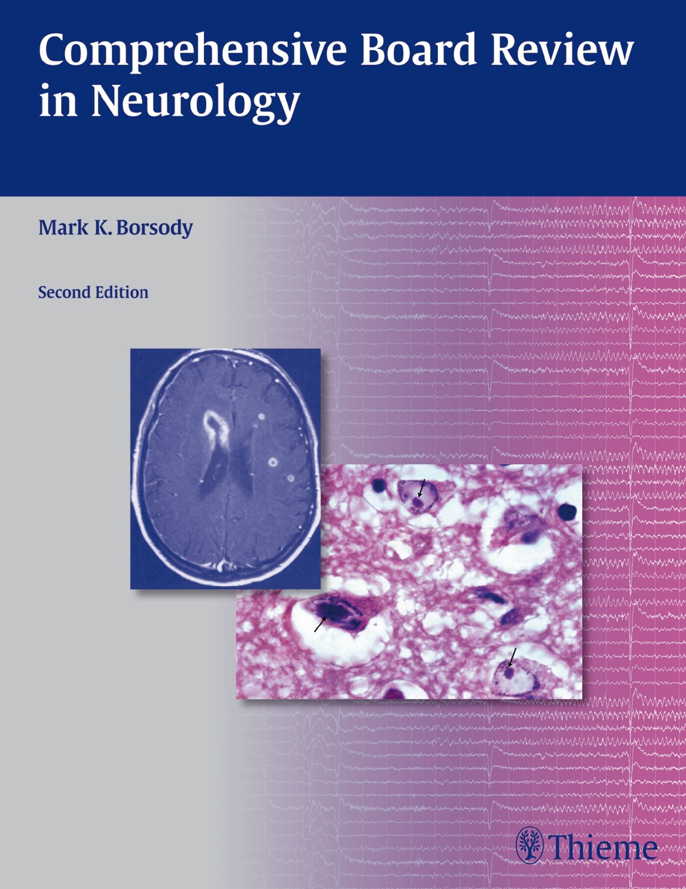 Comprehensive Board Review in Neurology, 9781604065930