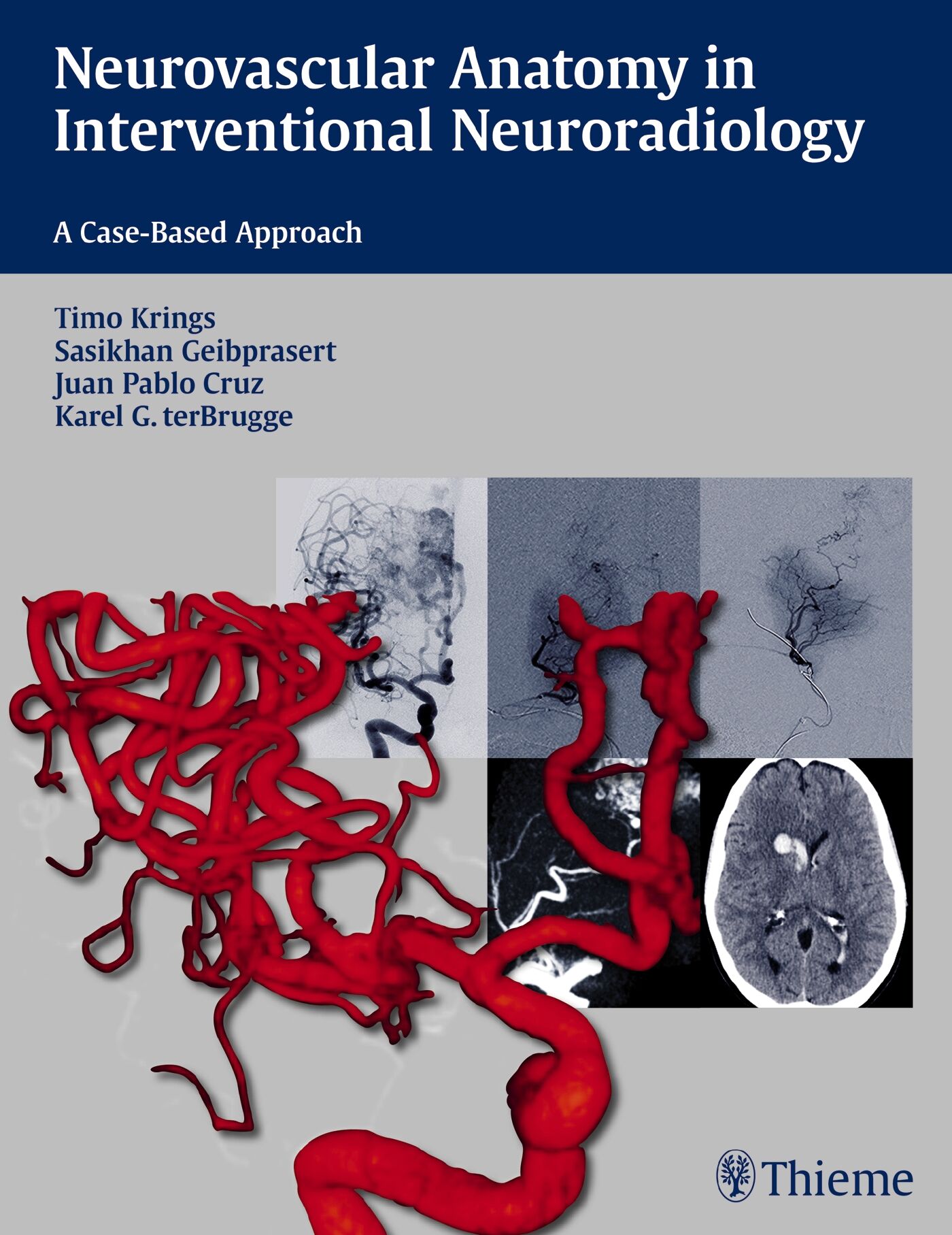 Neurovascular Anatomy in Interventional Neuroradiology, 9781604068399