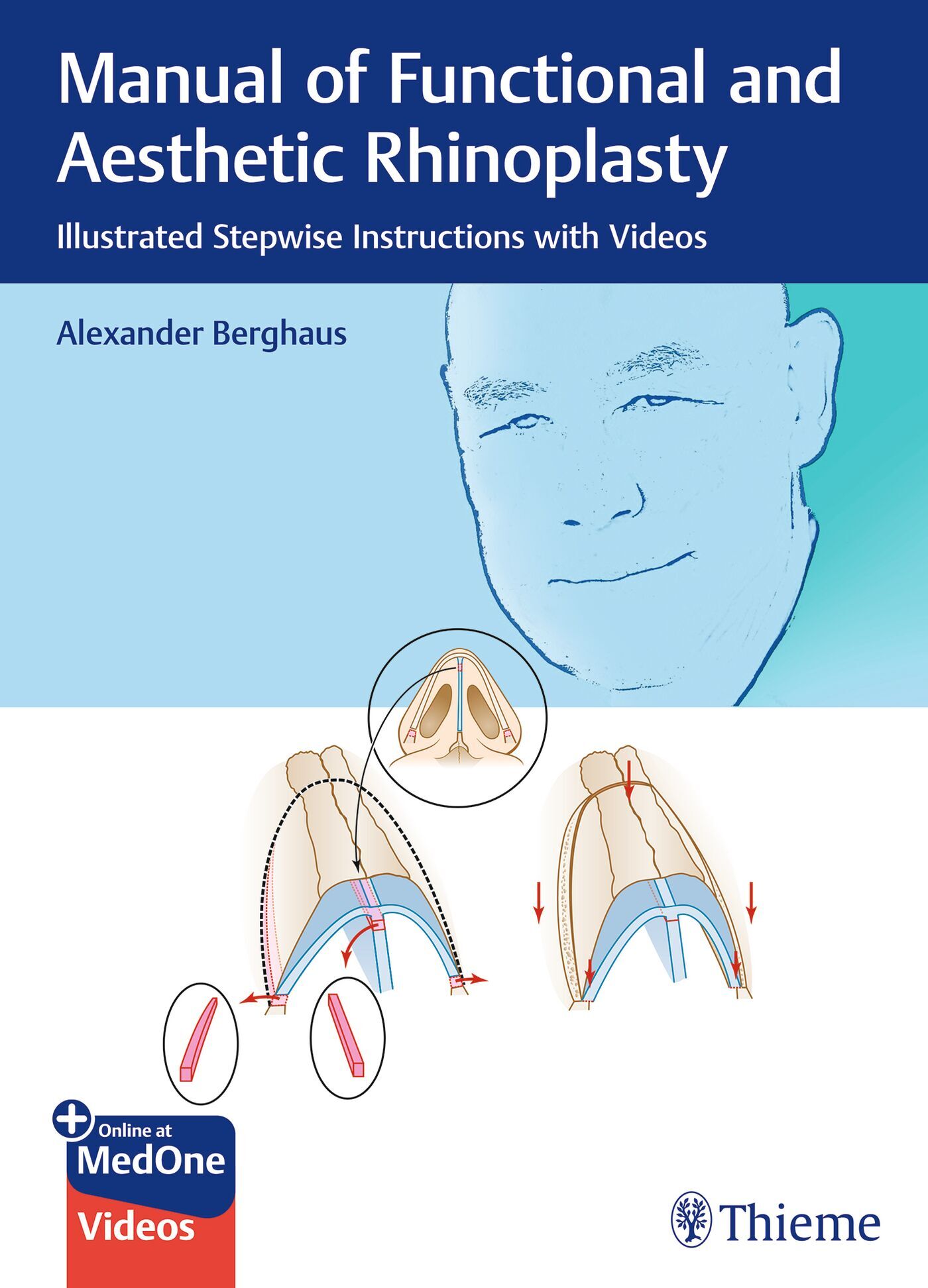 Manual of Functional and Aesthetic Rhinoplasty, 9783132582347