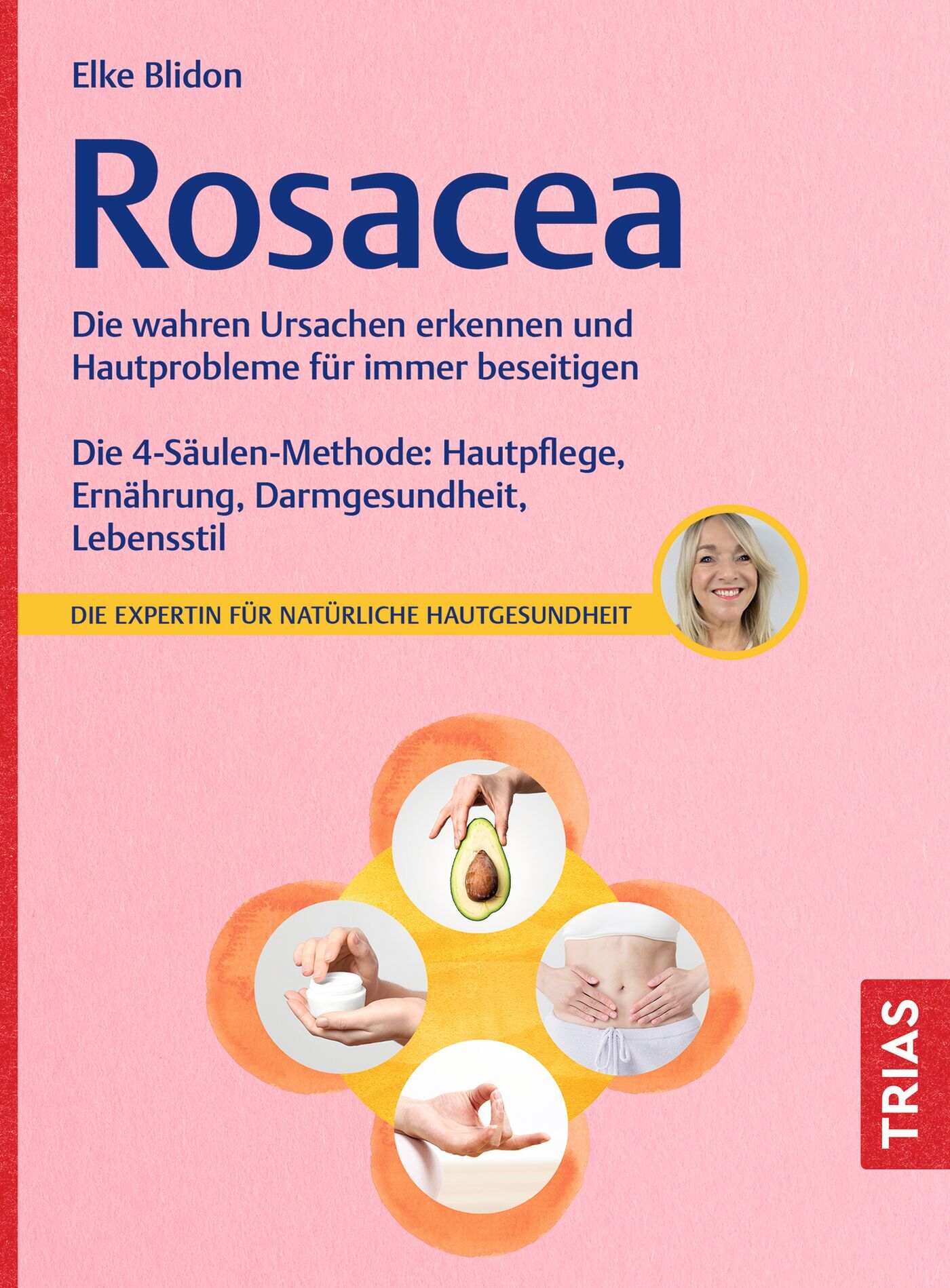 Rosacea, 9783432120362