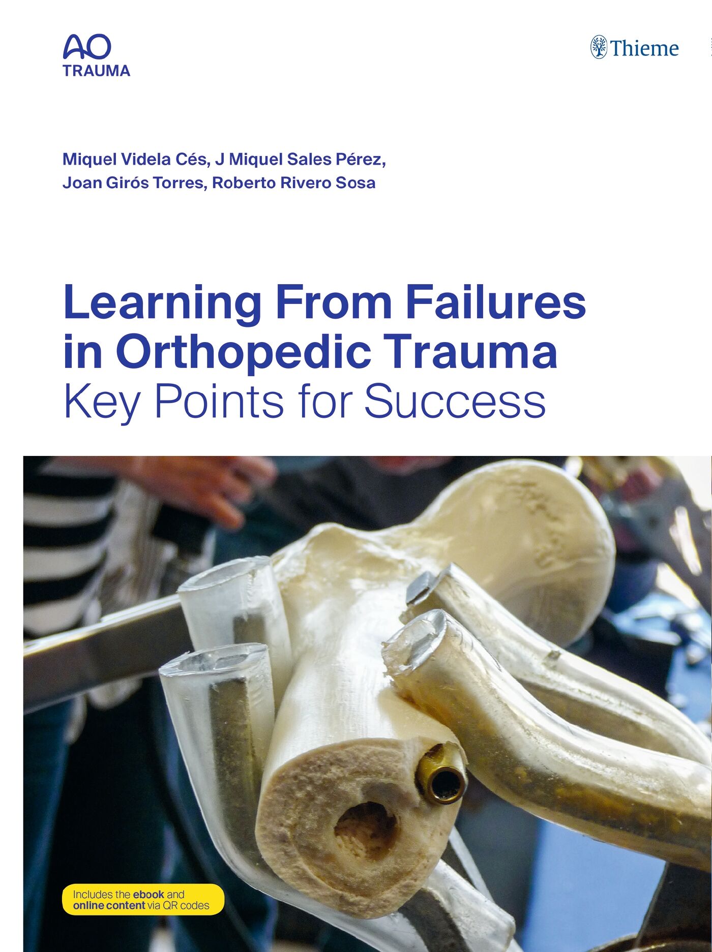 Learning From Failures in Orthopedic Trauma, 9783132434561