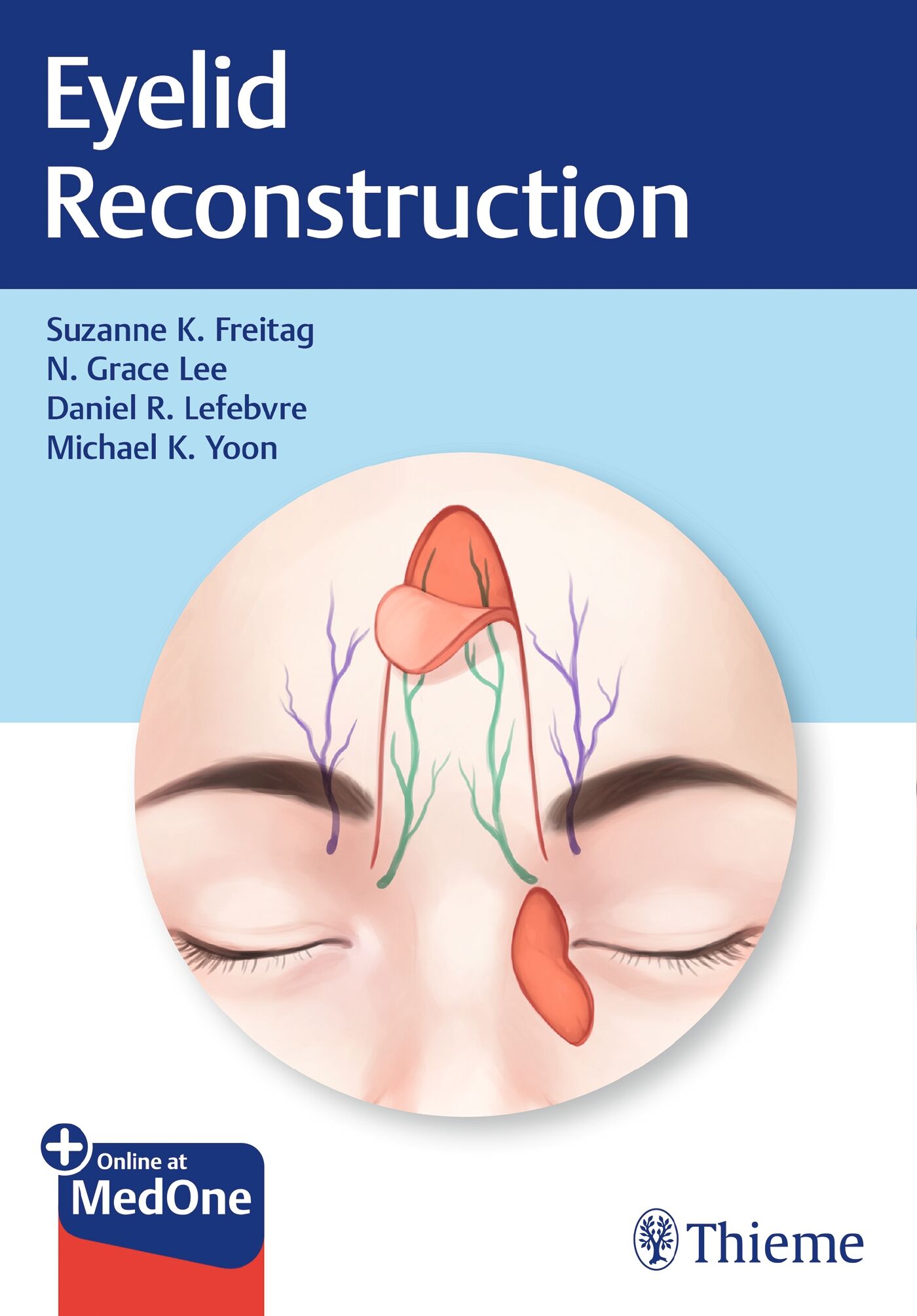 Eyelid Reconstruction, 9781626238237