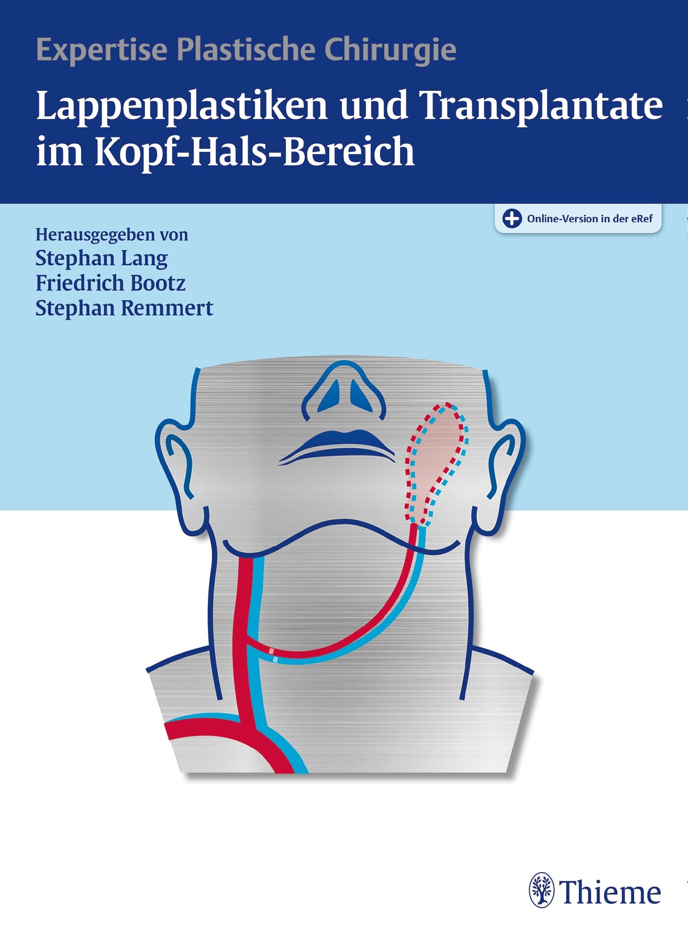 Lappenplastiken und Transplantate im Kopf-Hals-Bereich, 9783131981714
