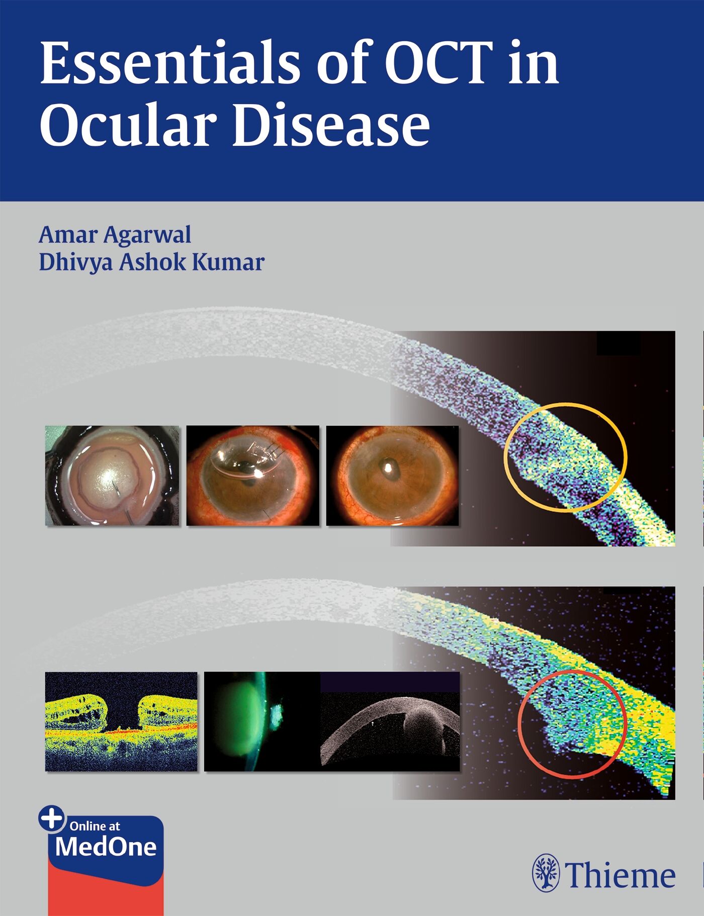 Essentials of OCT in Ocular Disease, 9781626230989