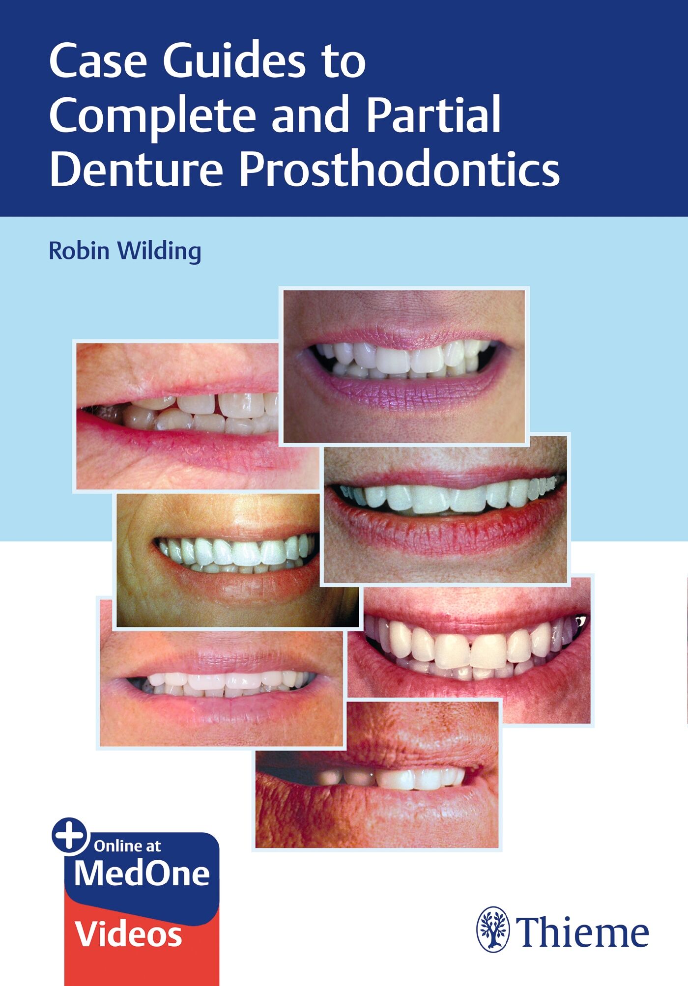 Case Guides to Complete and Partial Denture Prosthodontics, 9781684201709