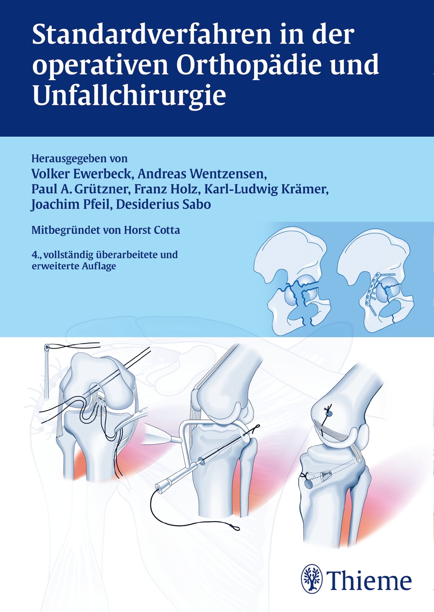 Standardverfahren in der operativen Orthopädie und Unfallchirurgie, 9783131774743