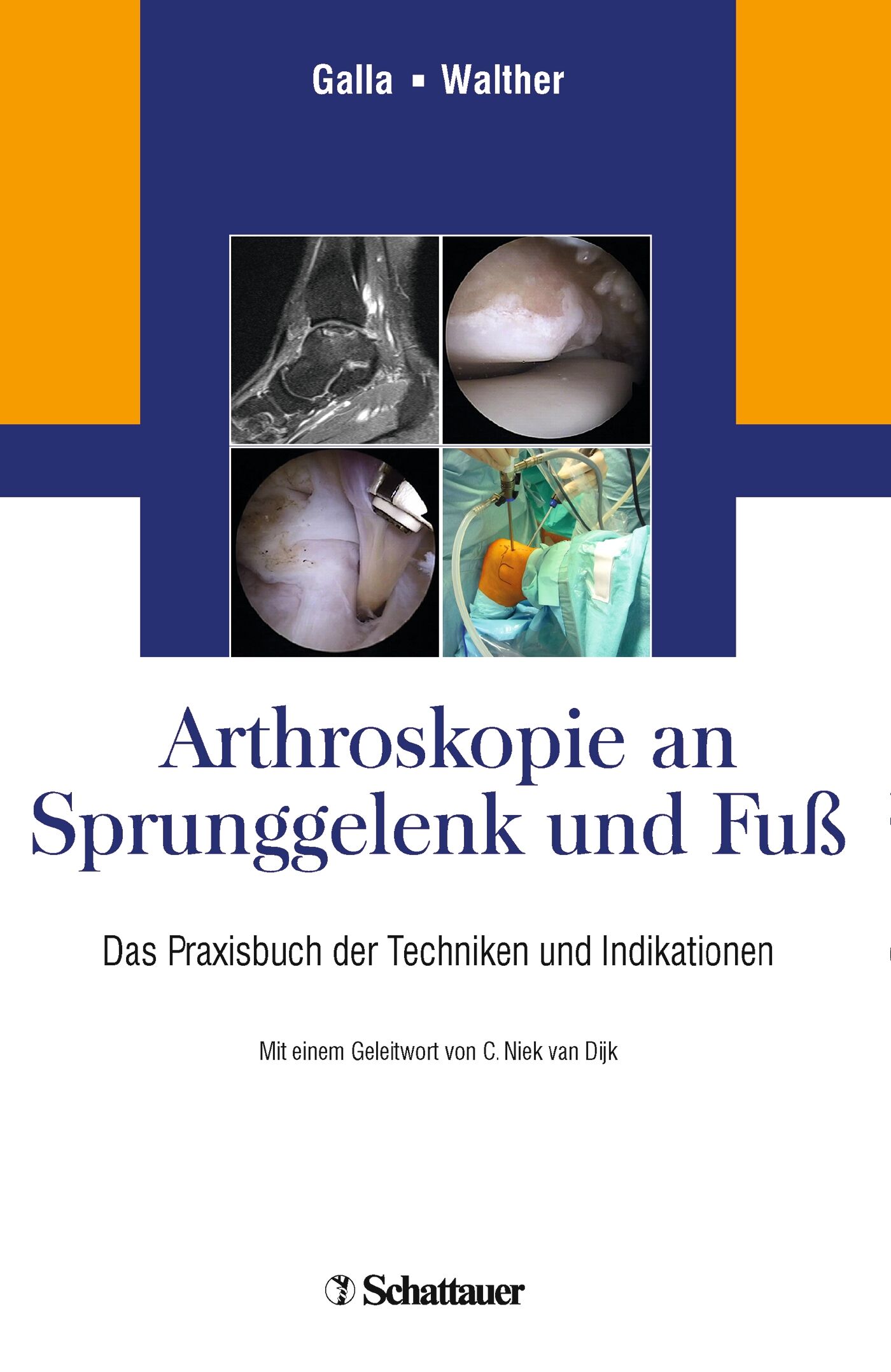Arthroskopie an Sprunggelenk und Fuß, 9783794529674
