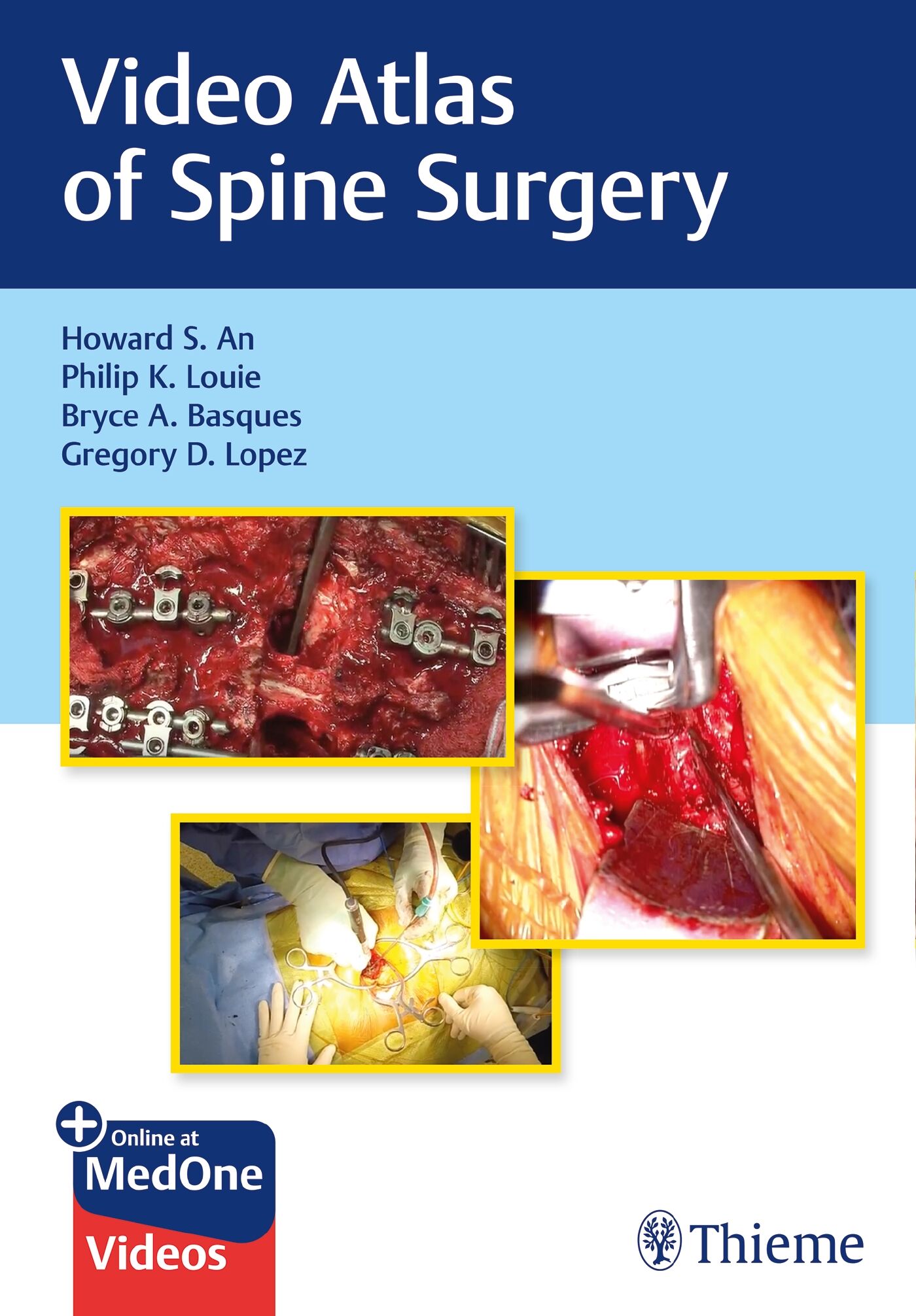 Video Atlas of Spine Surgery, 9781684200054