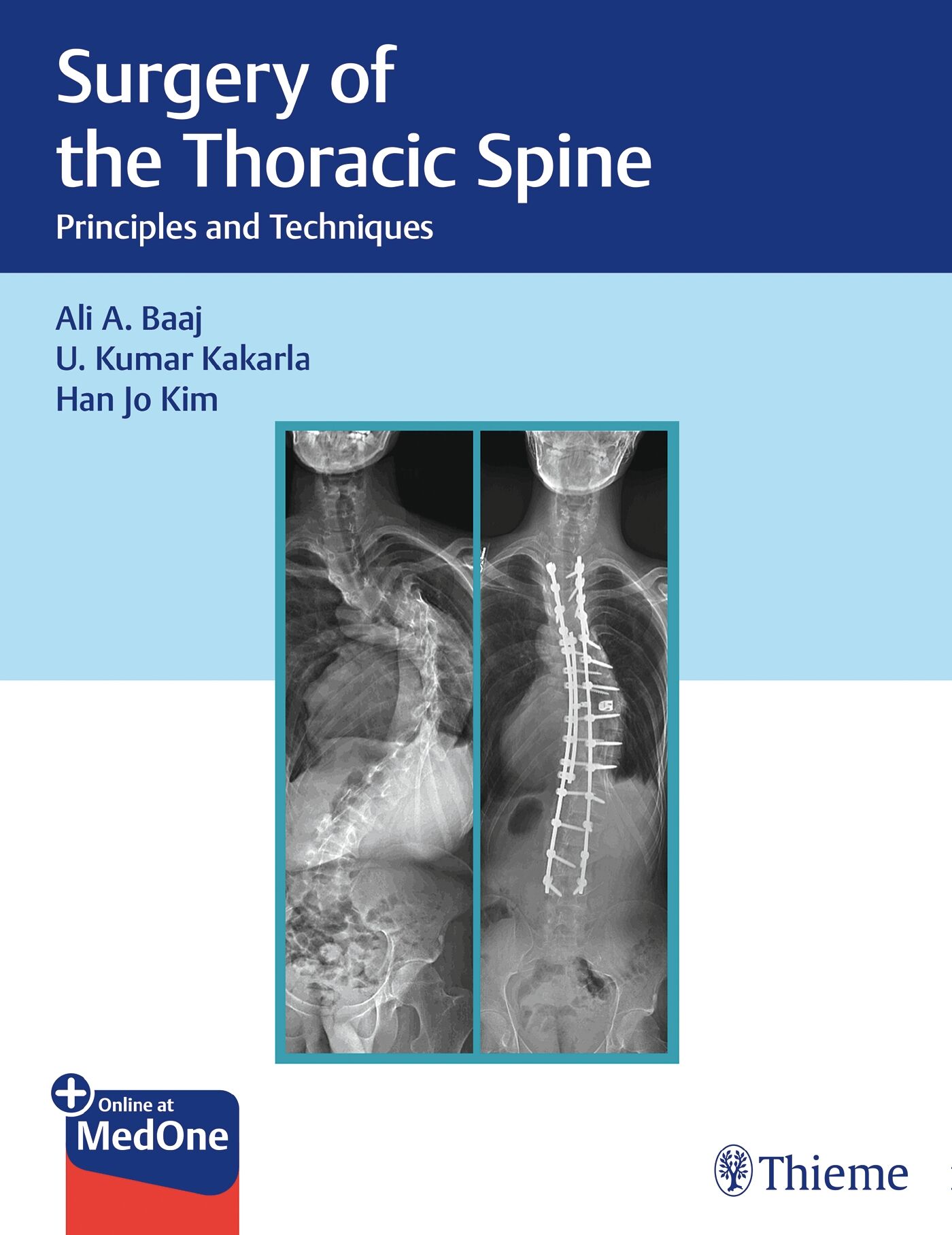 Surgery of the Thoracic Spine, 9781626238558