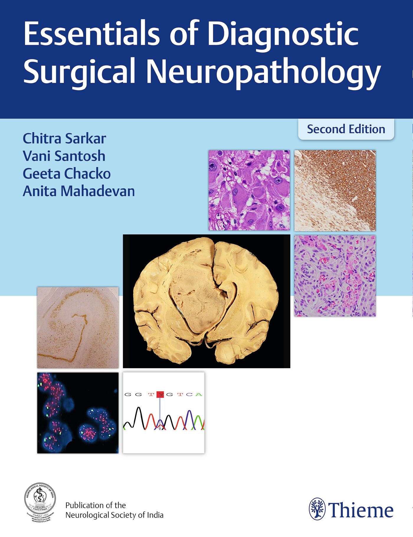 Essentials of Diagnostic Surgical Neuropathology, 9789395390088