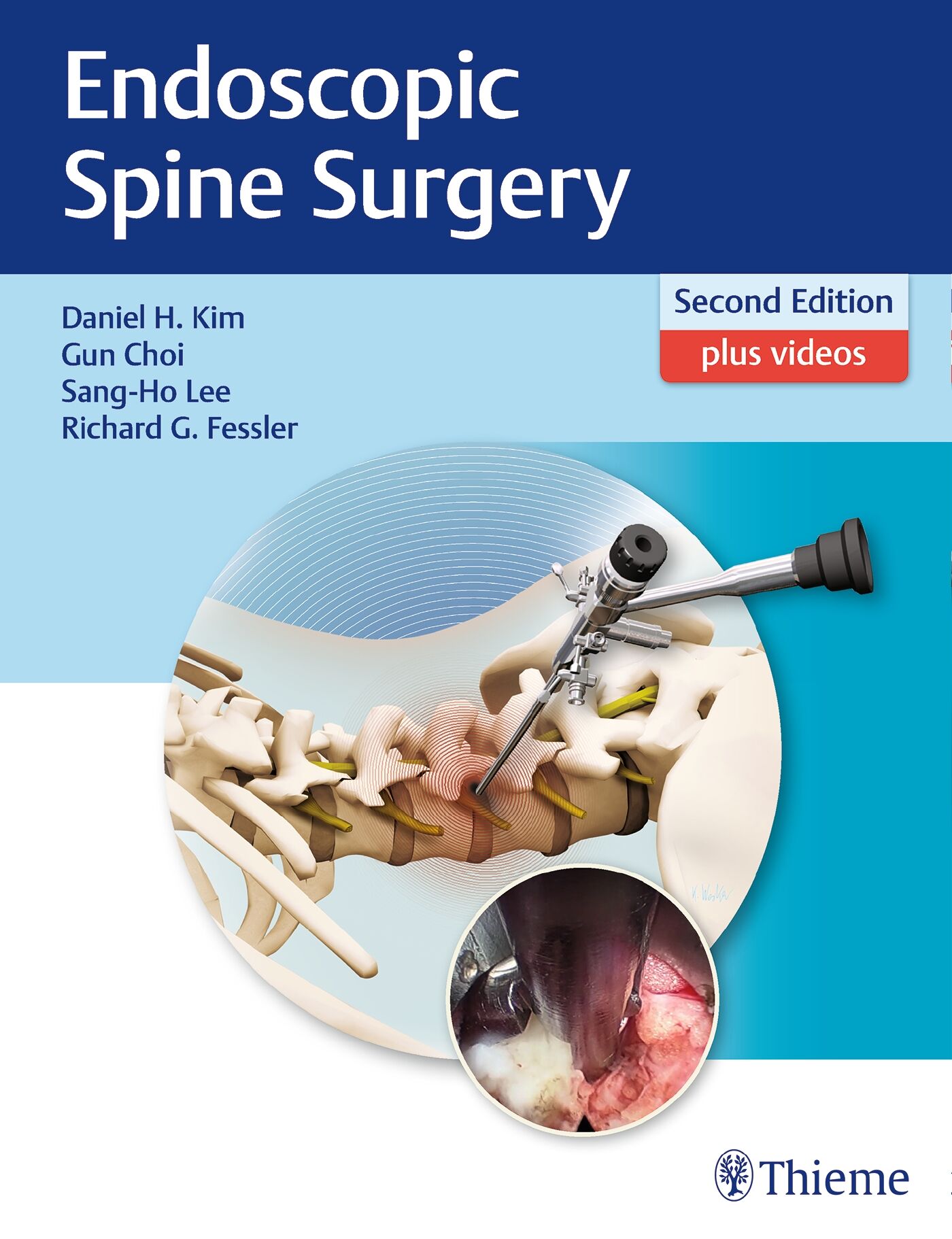 Endoscopic Spine Surgery, 9781626232648