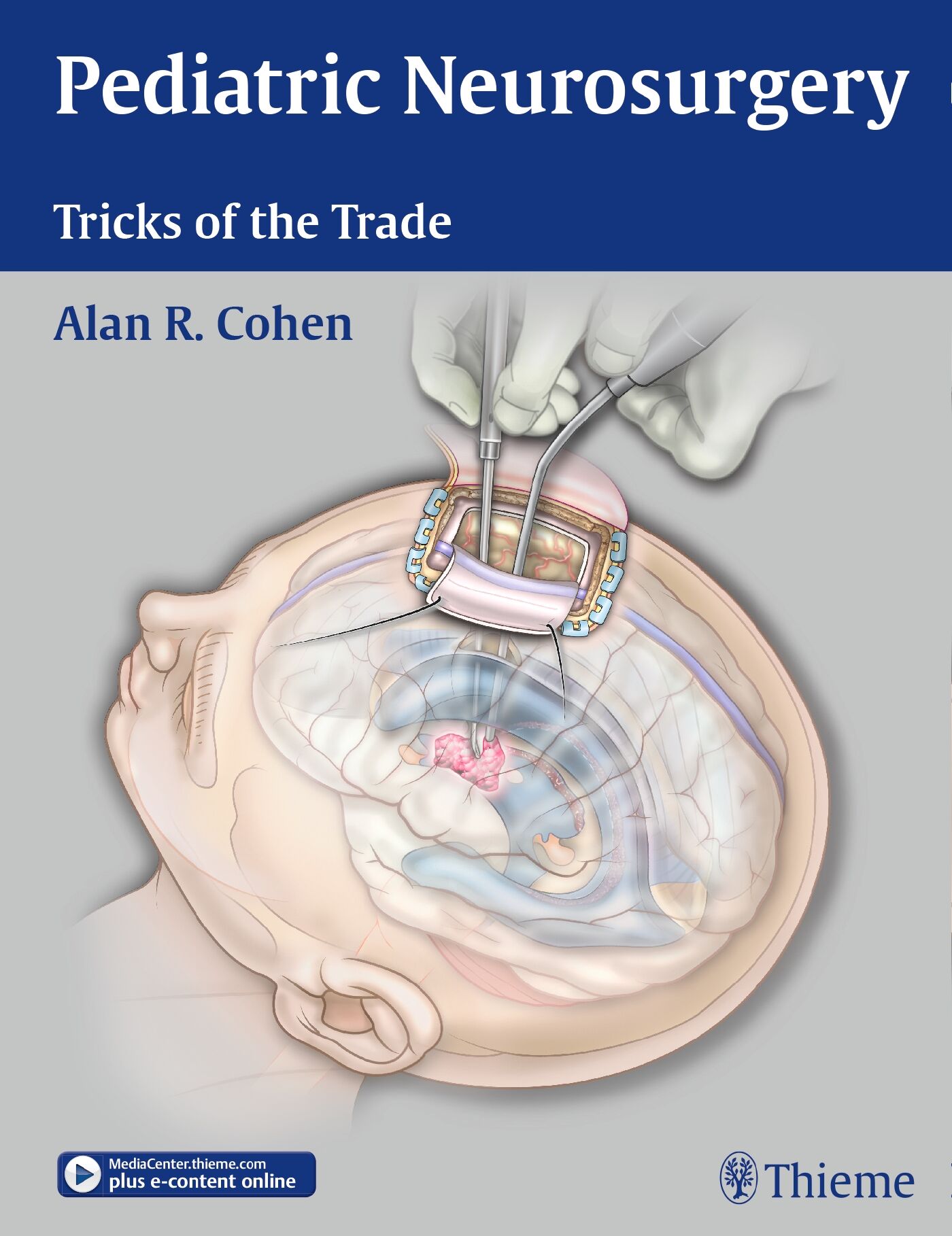 Pediatric Neurosurgery: Tricks of the Trade, 9781604068696