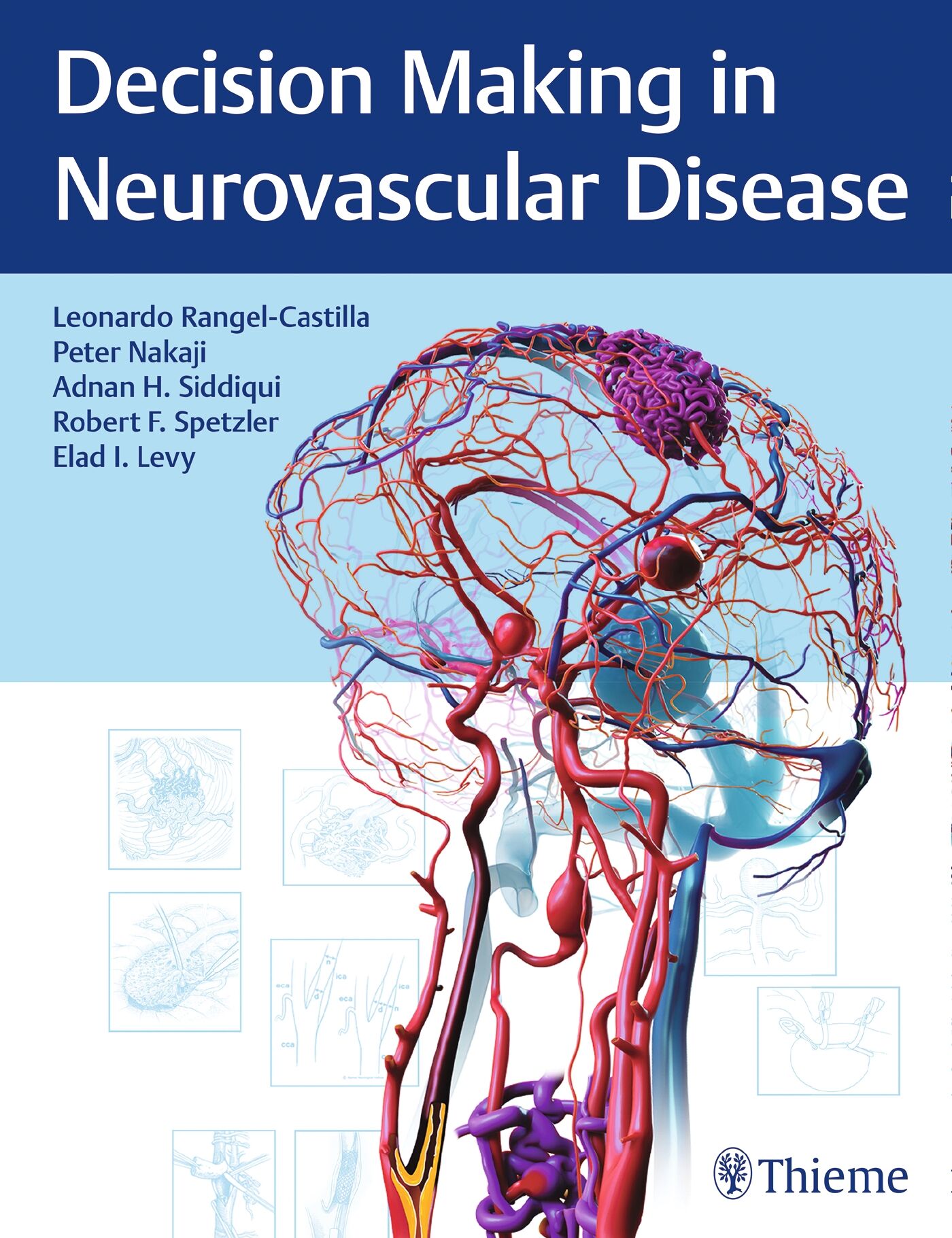 Decision Making in Neurovascular Disease, 9781684200573