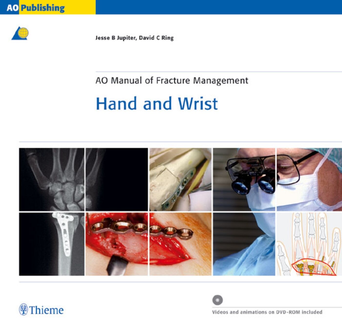 AO Manual of Fracture Management - Hand and Wrist, 9783131276117