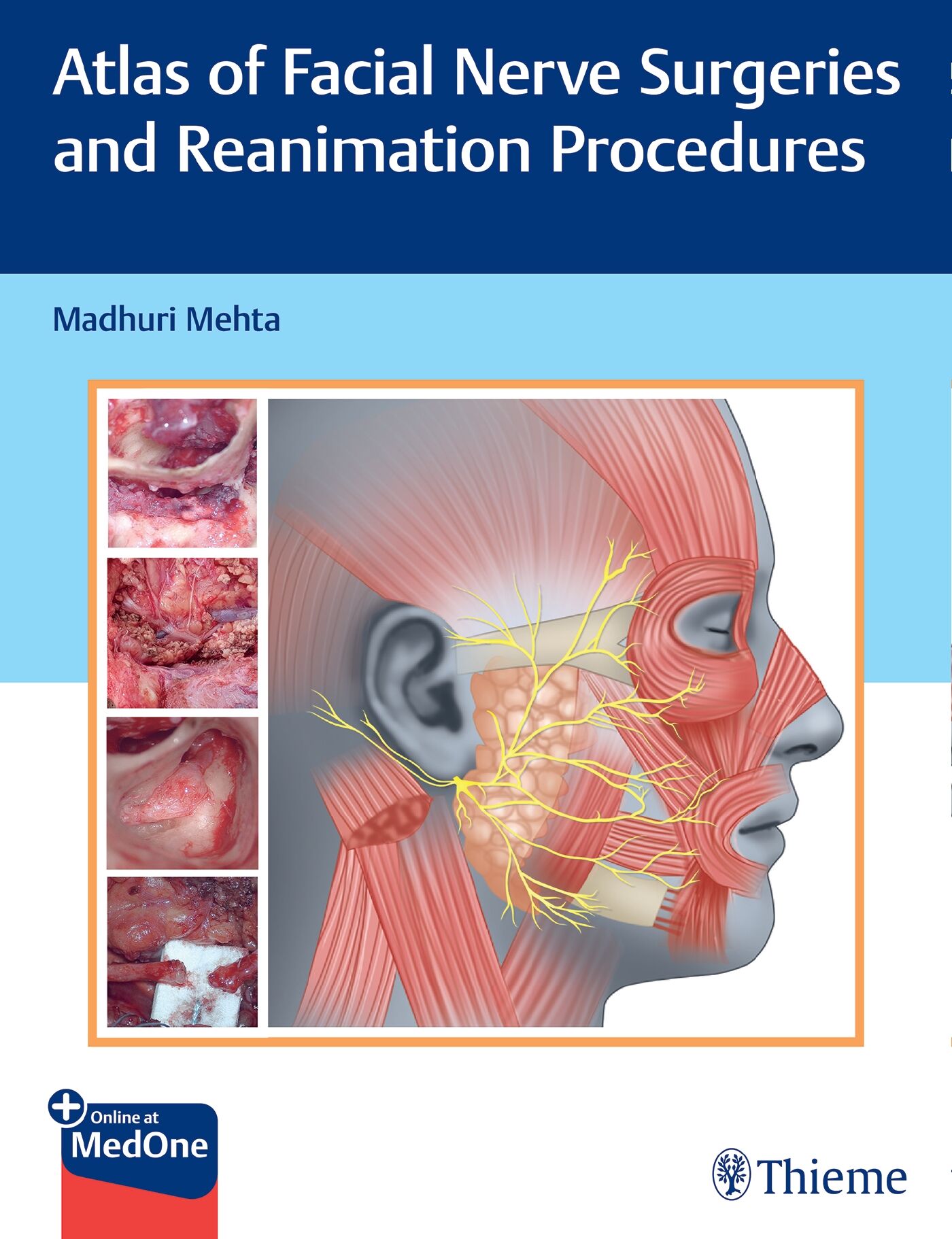 Atlas of Facial Nerve Surgeries and Reanimation Procedures, 9789395390163