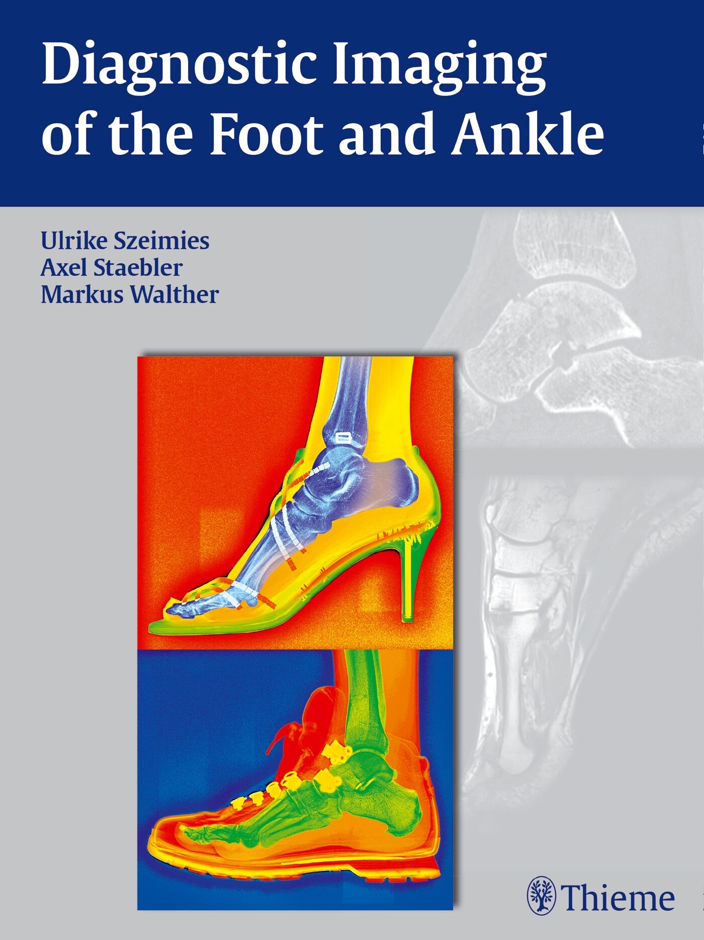 Diagnostic Imaging of the Foot and Ankle, 9783131764614