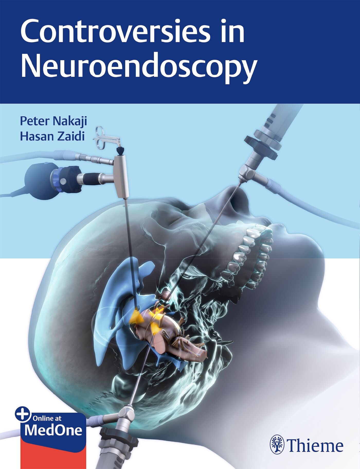 Controversies in Neuroendoscopy, 9781626233539