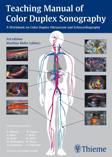 Teaching Manual of Color Duplex Sonography, 9783131275936