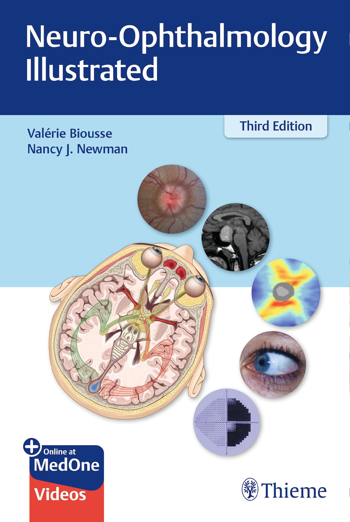 Neuro-Ophthalmology Illustrated, 9781684200757