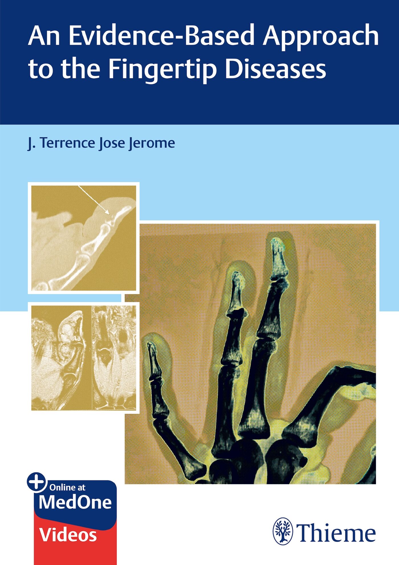 An Evidence-Based Approach to the Fingertip Diseases, 9789392819360