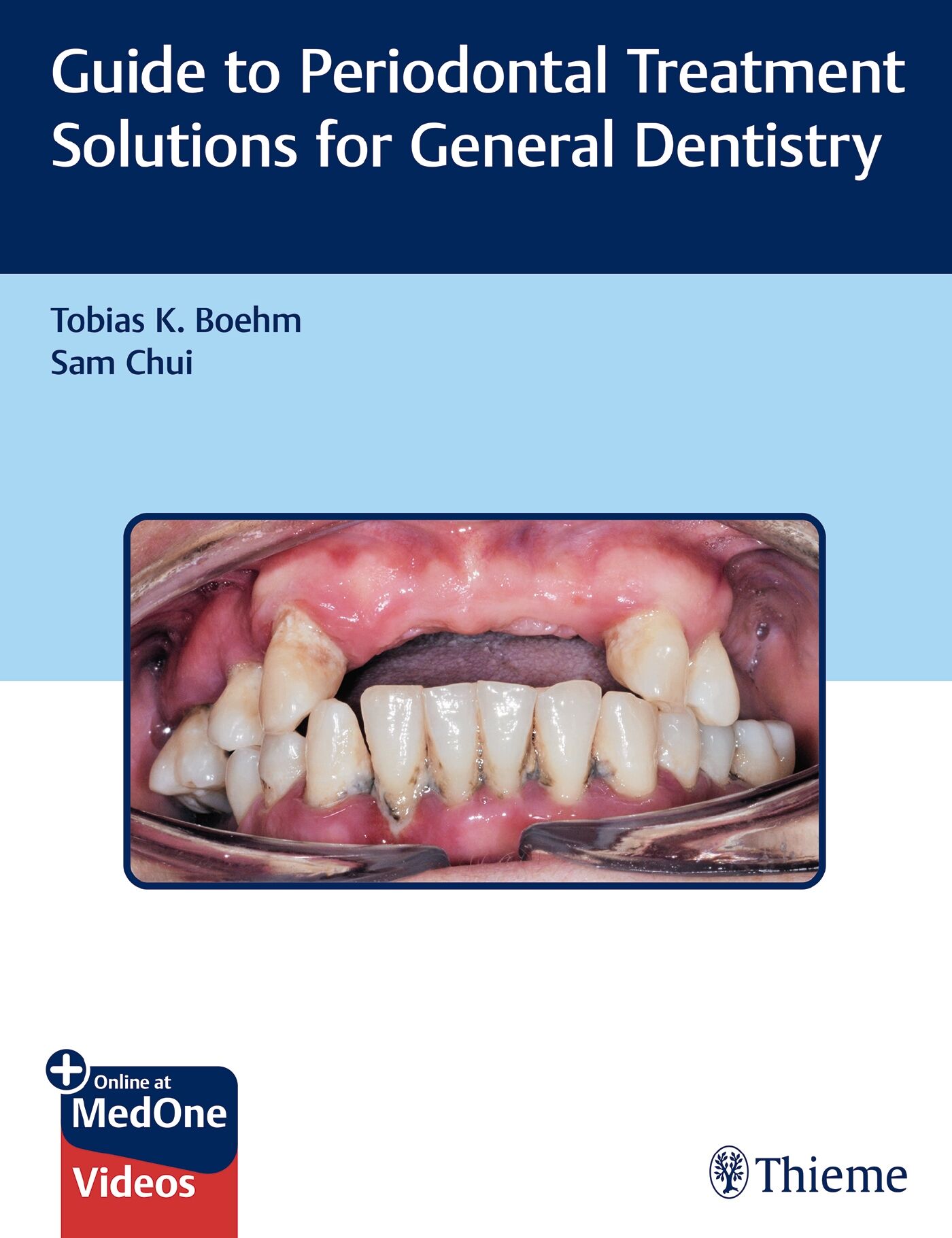 Guide to Periodontal Treatment Solutions for General Dentistry, 9781626238008