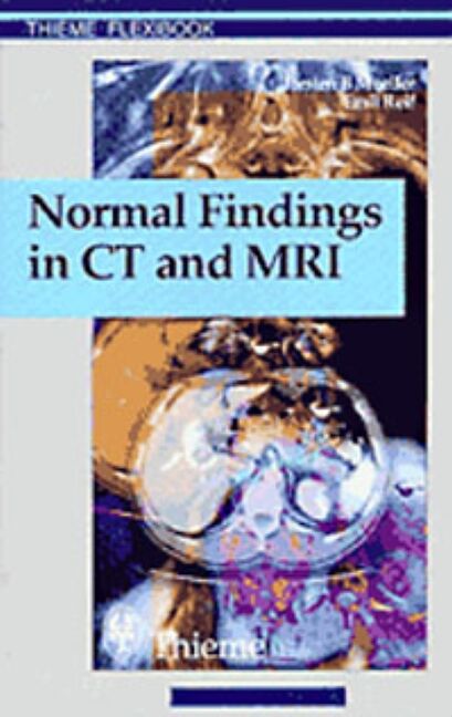 Normal Findings in CT and MRI, A1, print, 9783131165213