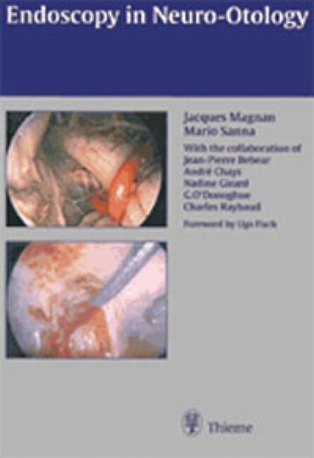 Endoscopy in Neuro-Otology and Skull Base Surgery (AT), 9783131130617