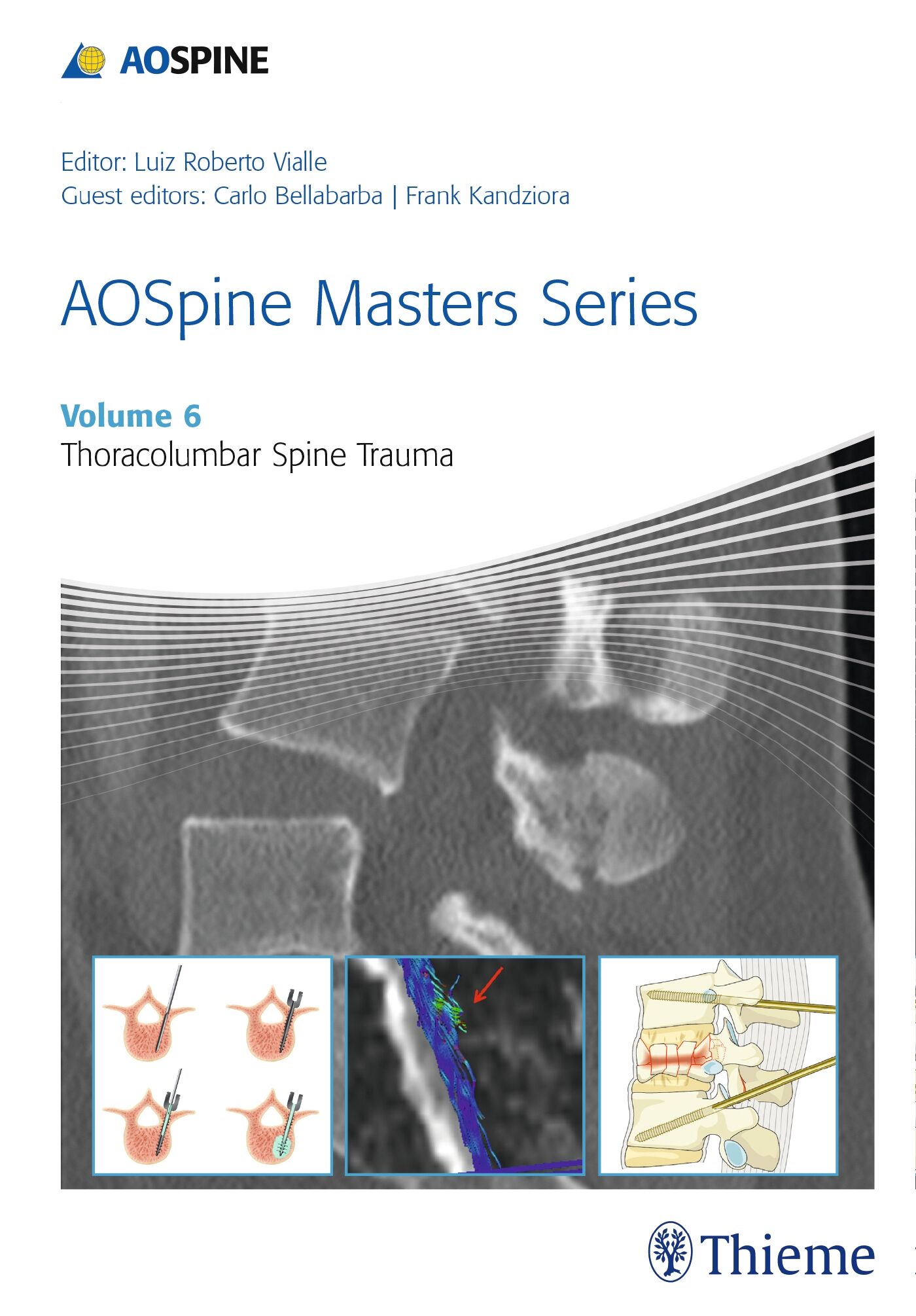 AOSpine Masters Series, Volume 6: Thoracolumbar Spine Trauma, 9781626232259