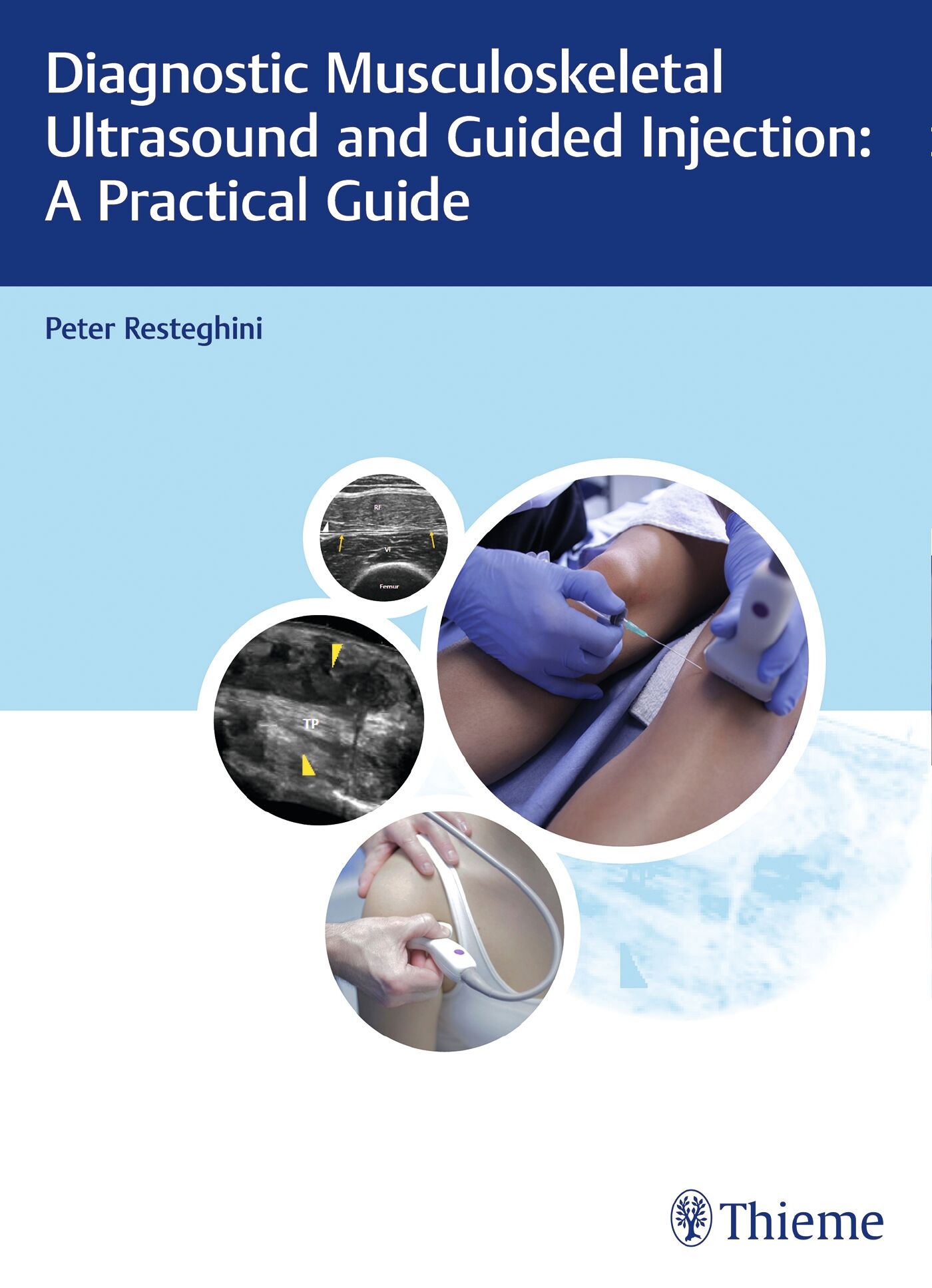Diagnostic Musculoskeletal Ultrasound and Guided Injection: A Practical Guide, 9783132203815
