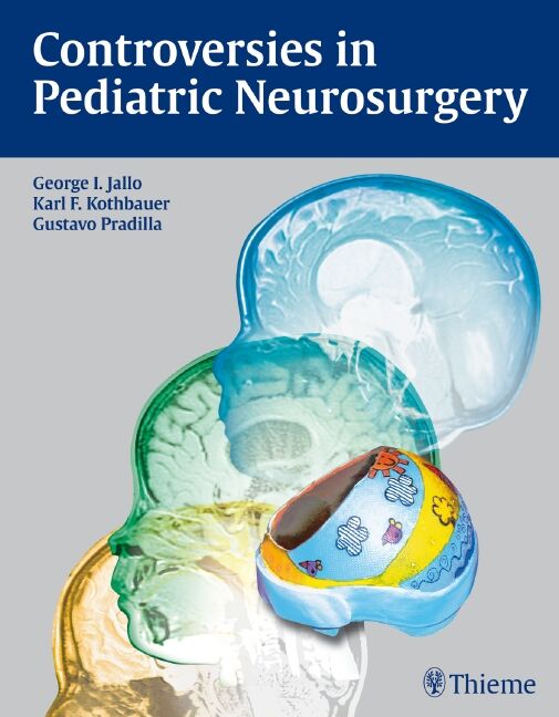 Controversies in Pediatric Neurosurgery, 9781604060744