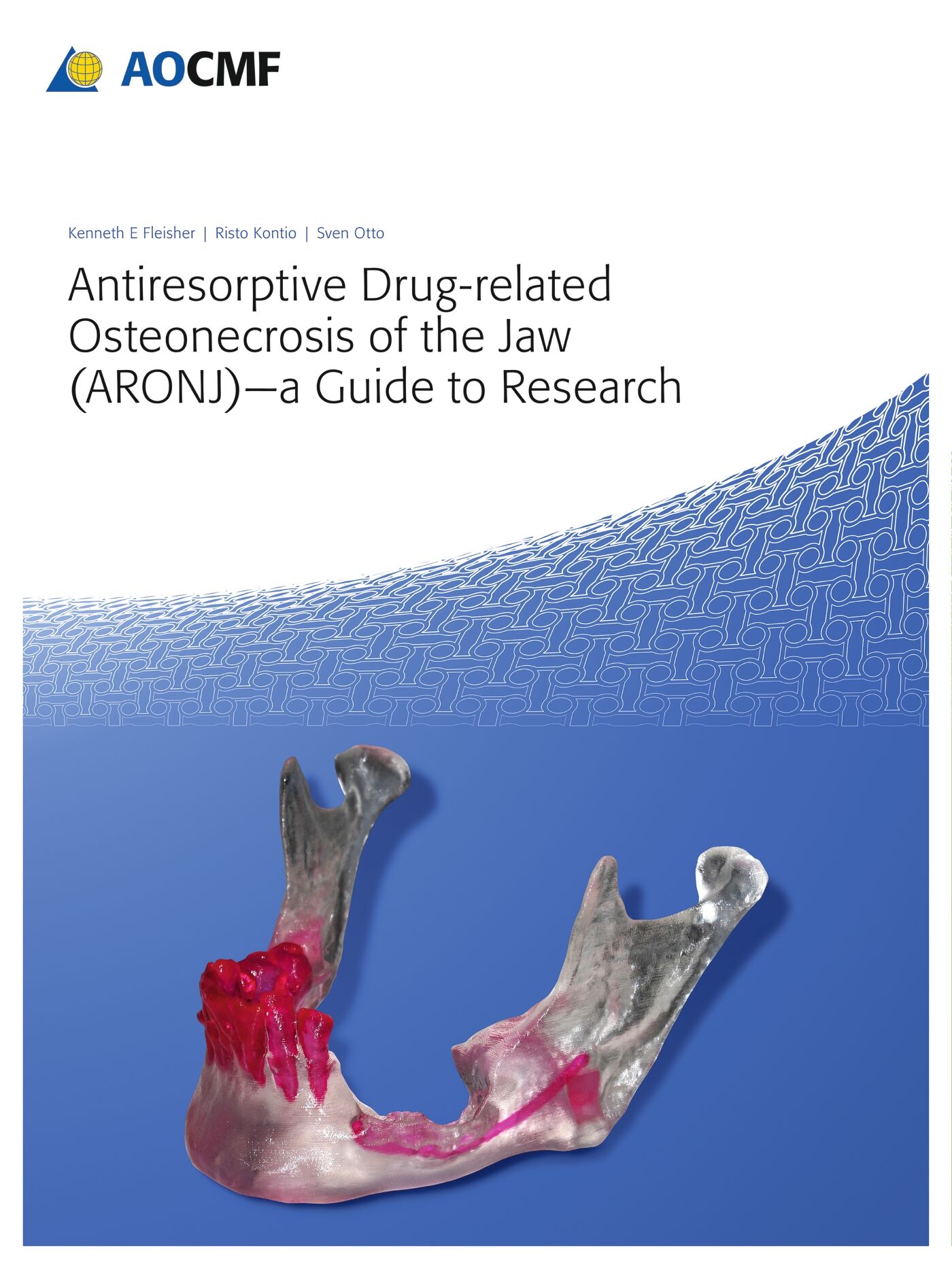 Antiresorptive Drug-Related Osteonecrosis of the Jaw (ARONJ) - A Guide to Research, 9783132412712