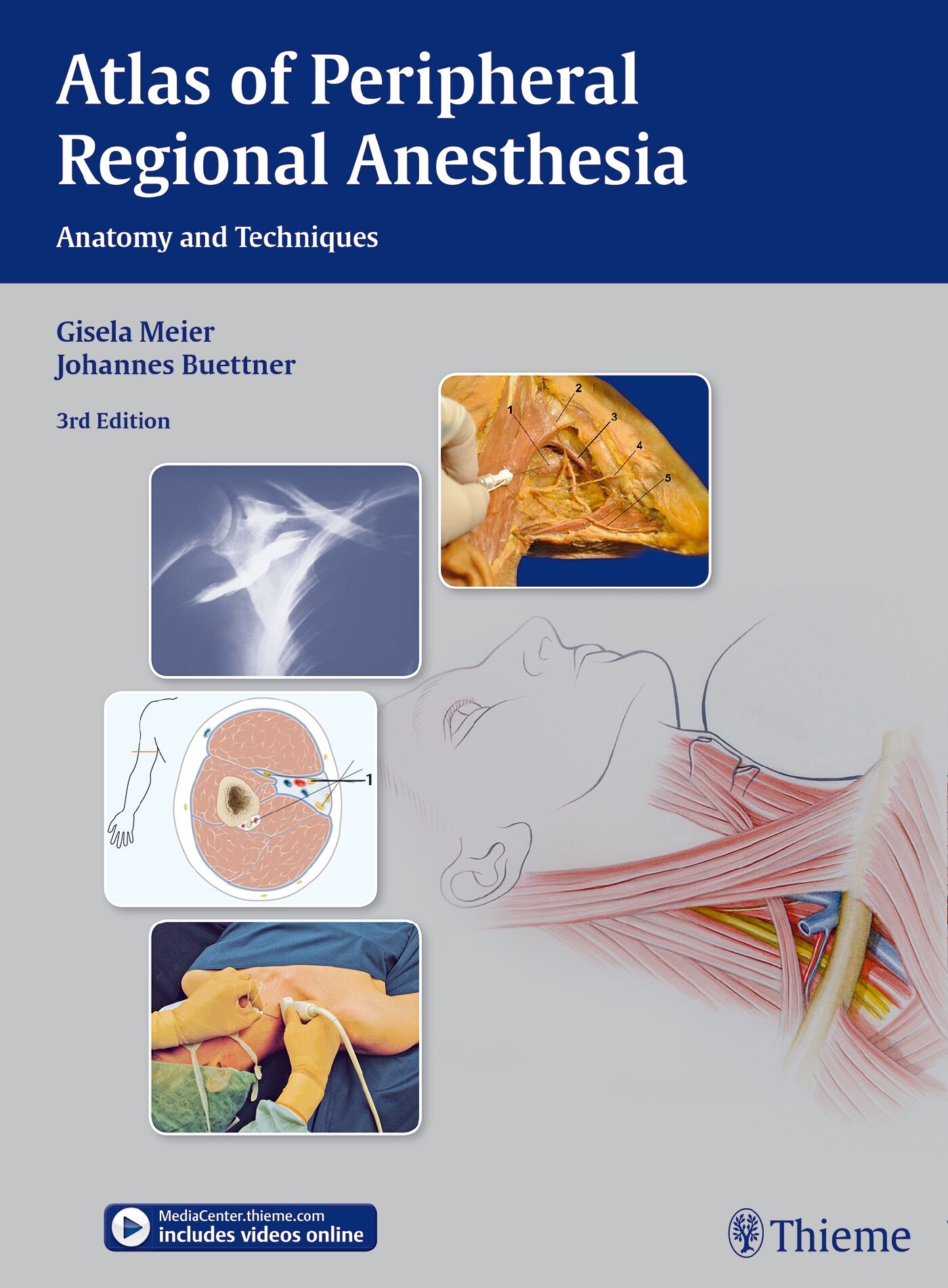 Atlas of Peripheral Regional Anesthesia, 9783131397935