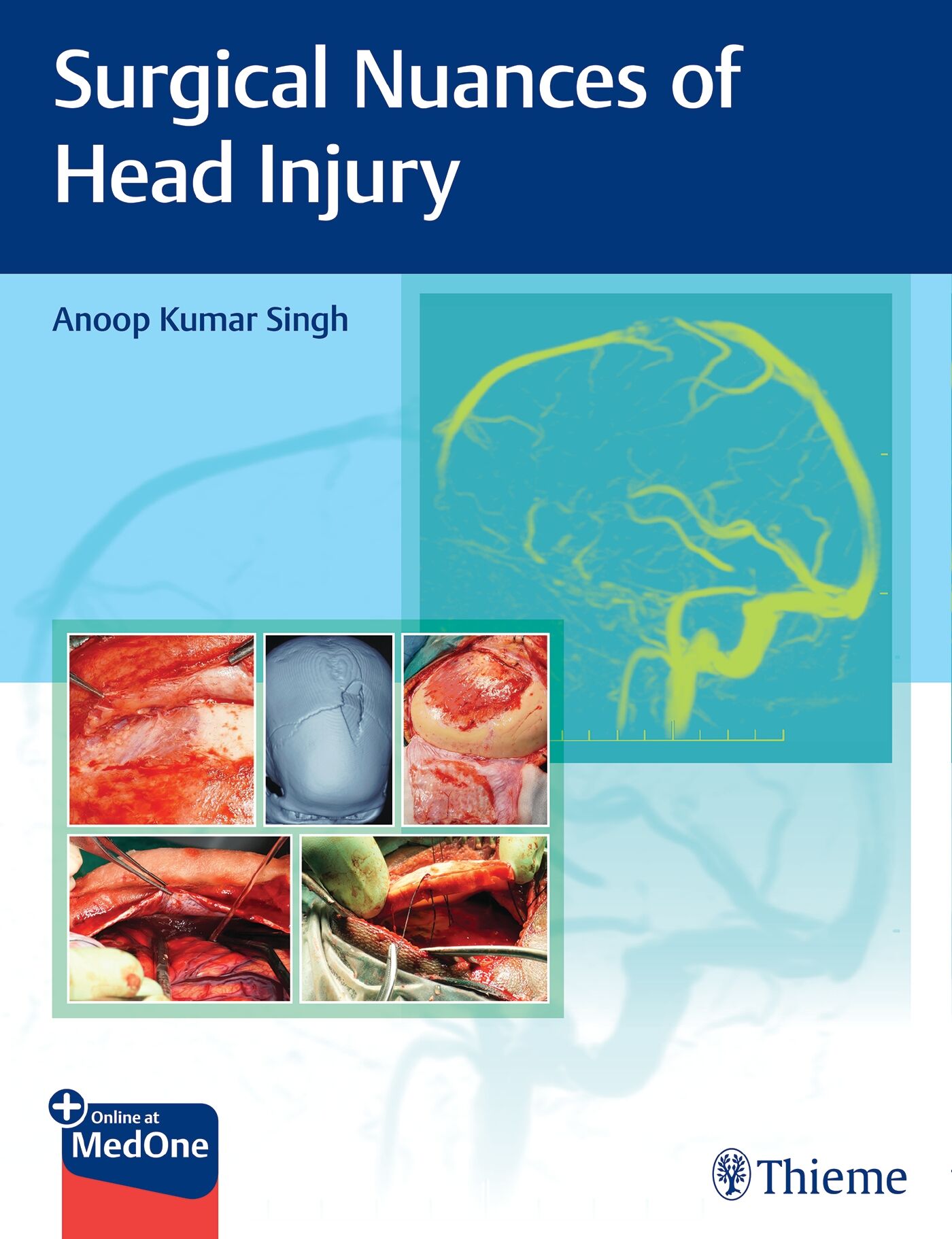 Surgical Nuances of Head Injury, 9789395390255